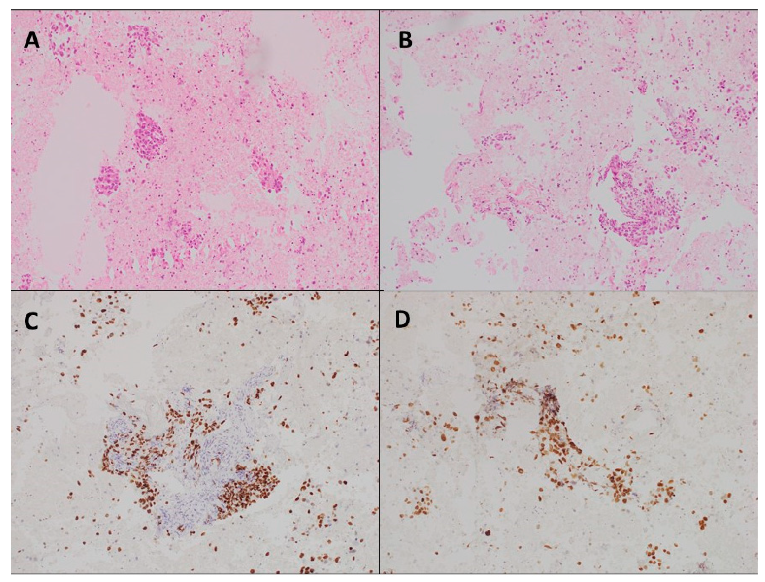 JCM | Free Full-Text | Diagnostic Performance and Cell Count of  EBUS–TBNA Needle Gauges: A Prospective Trial