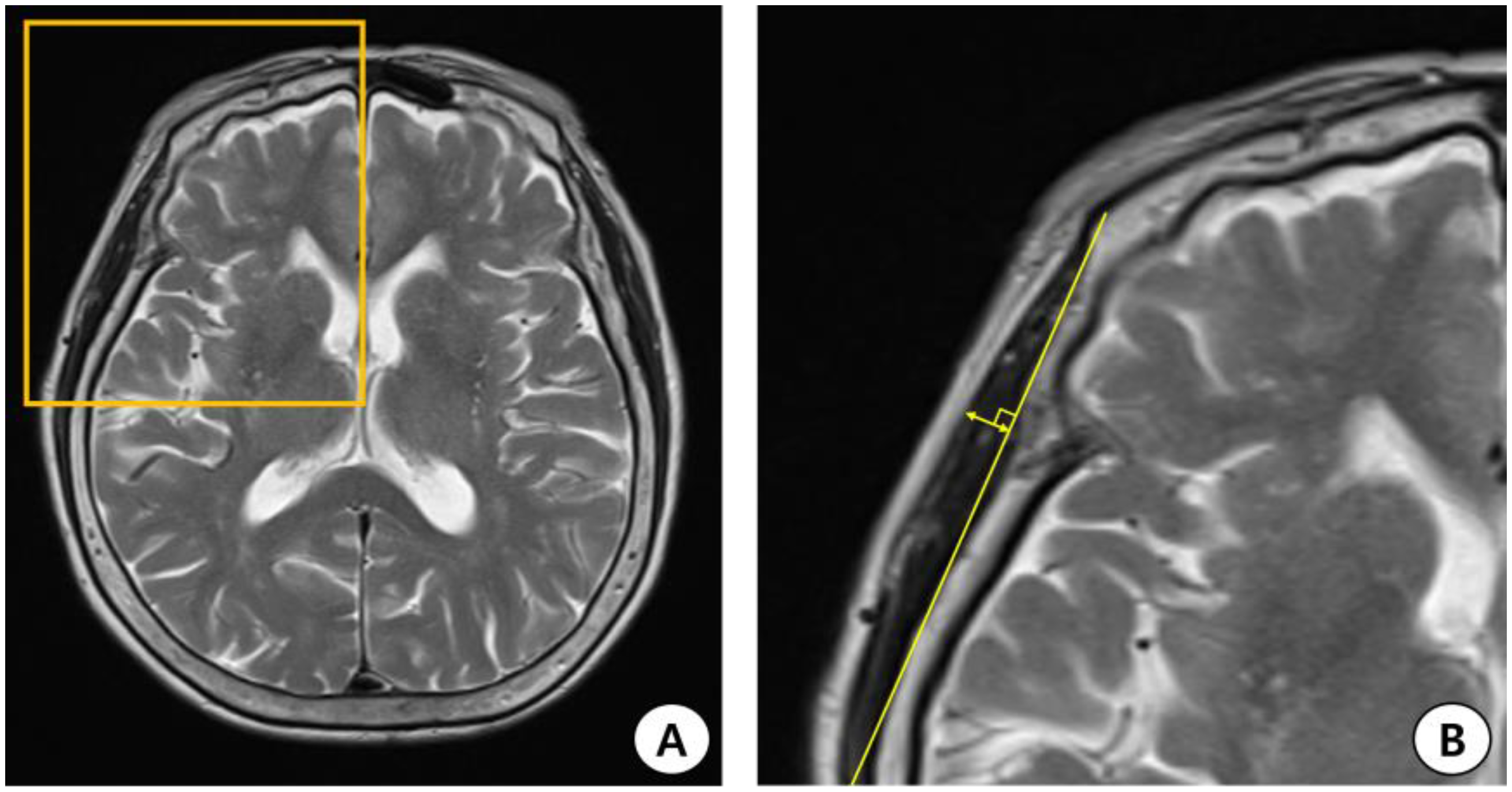 Jcm 12 04071 g001 Jcm 12 04071 g001