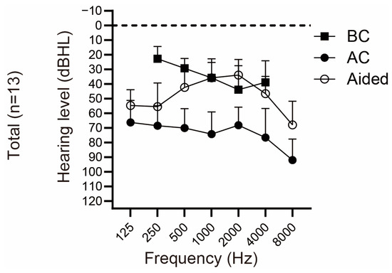 Hearing Outcome and Predictors after Implanting Bone Conduction or ...
