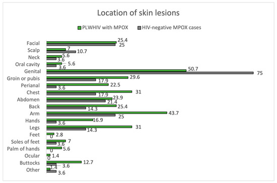 Mpox as AIDS-defining event with a severe and protracted course