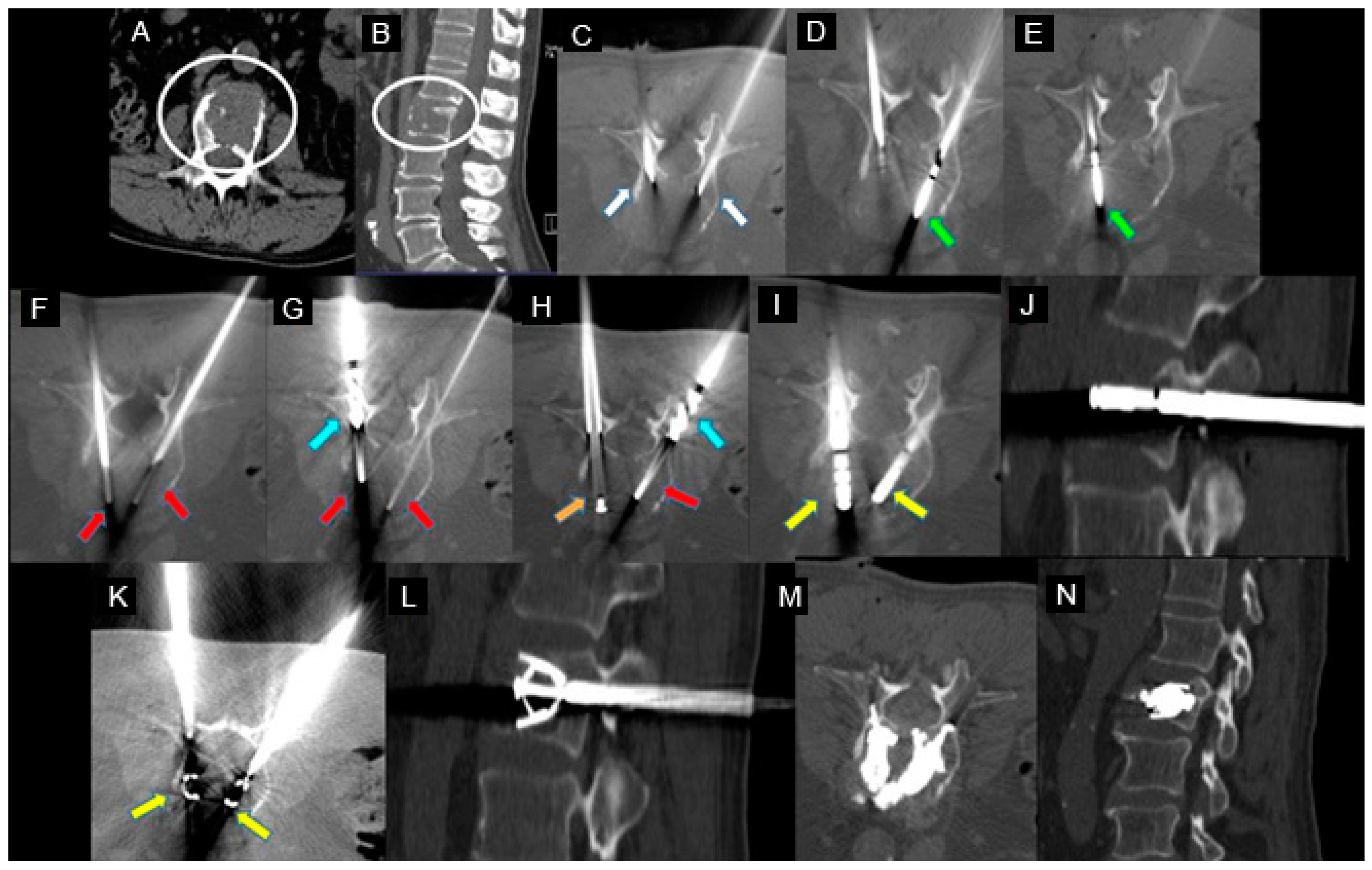 Jcm 12 04178 g002 Jcm 12 04178 g002