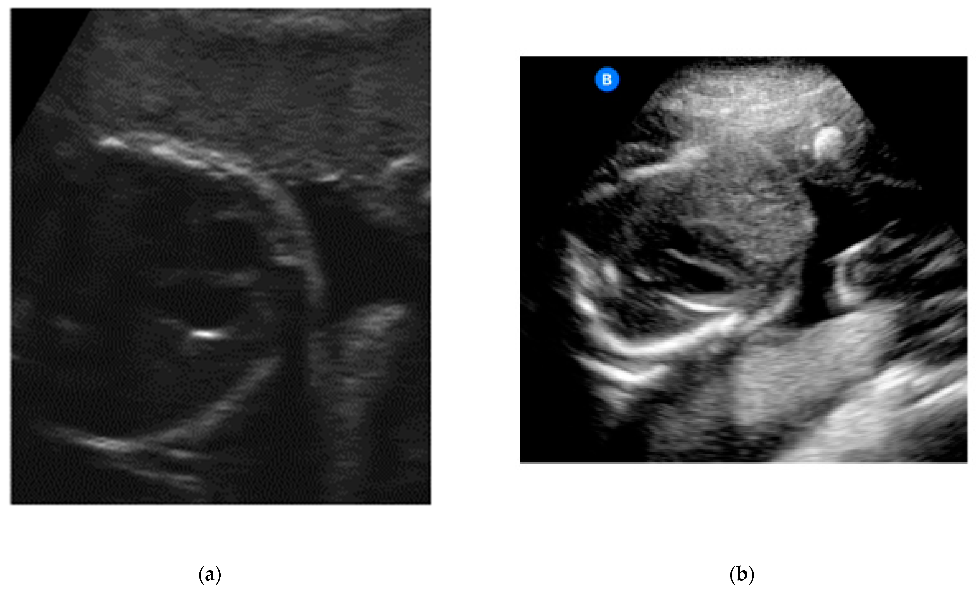 Jcm 12 04224 g002 Jcm 12 04224 g002