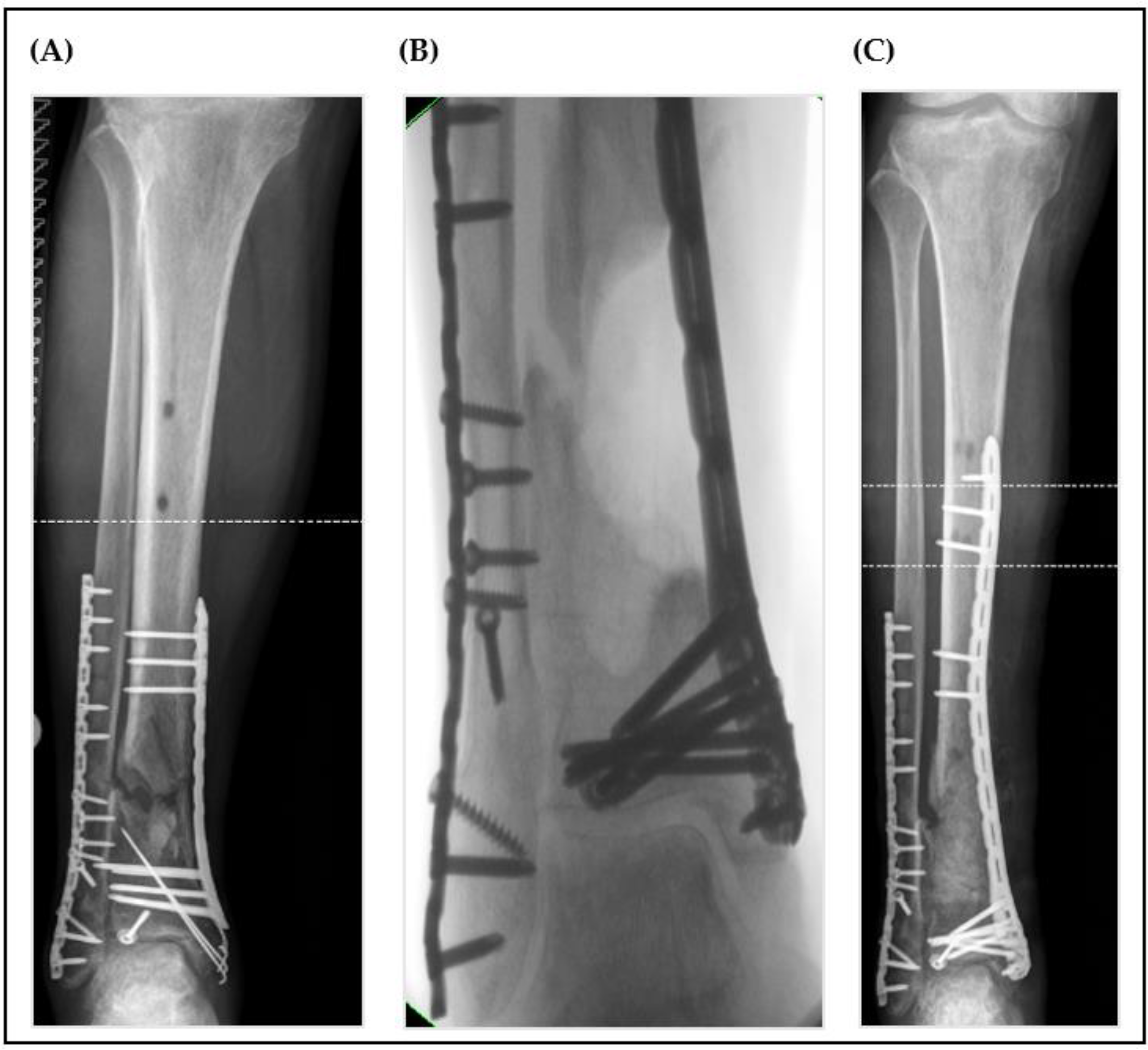 Jcm 12 04239 g002 Jcm 12 04239 g002