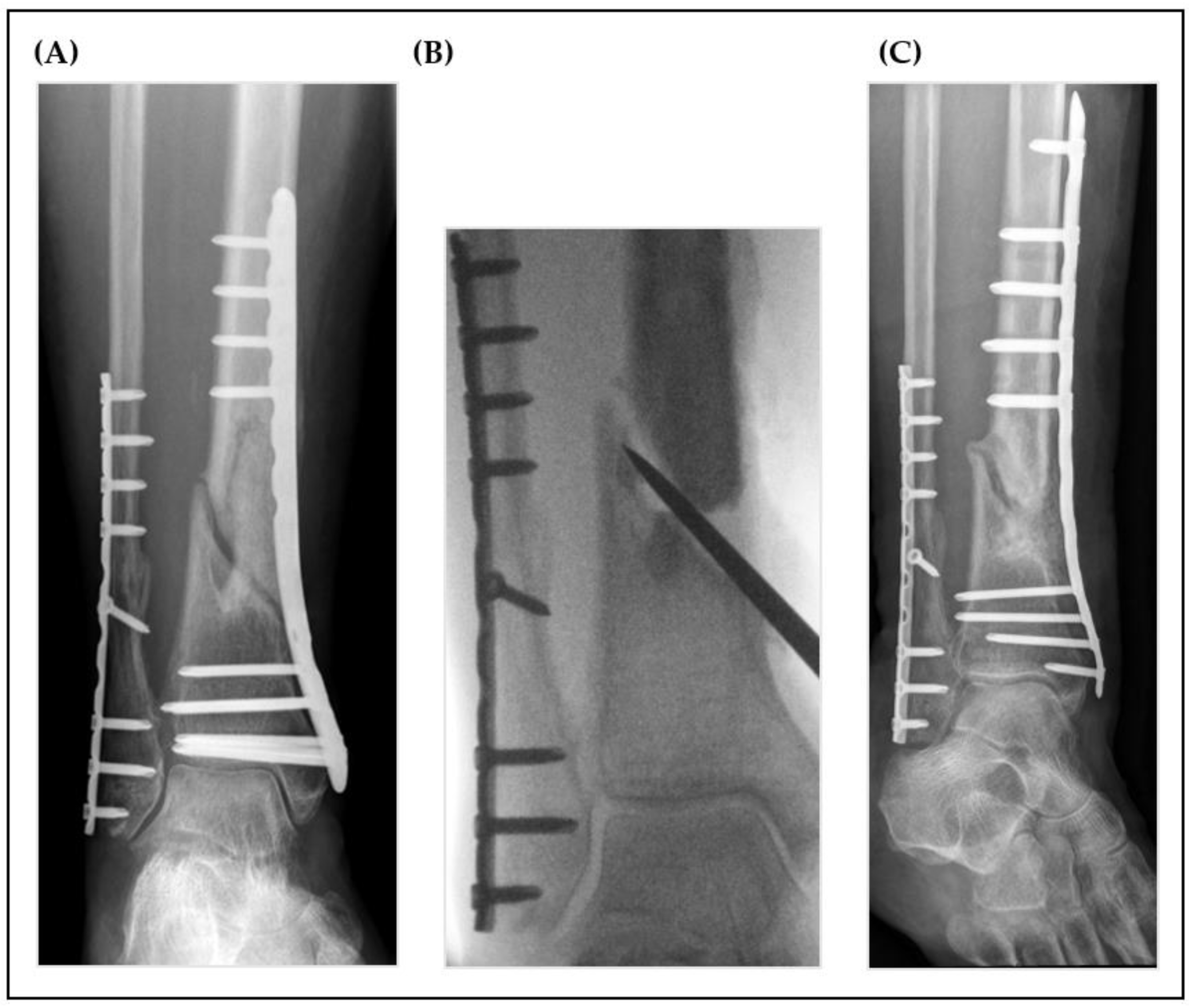 Jcm 12 04239 g003 Jcm 12 04239 g003