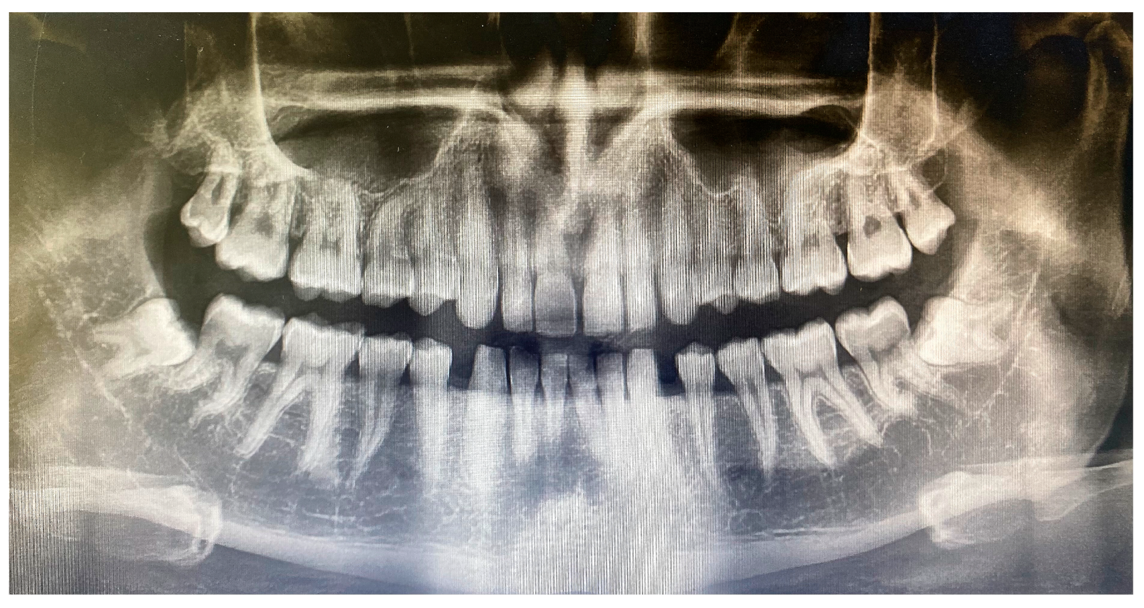 Jcm 12 04250 g002 Jcm 12 04250 g002