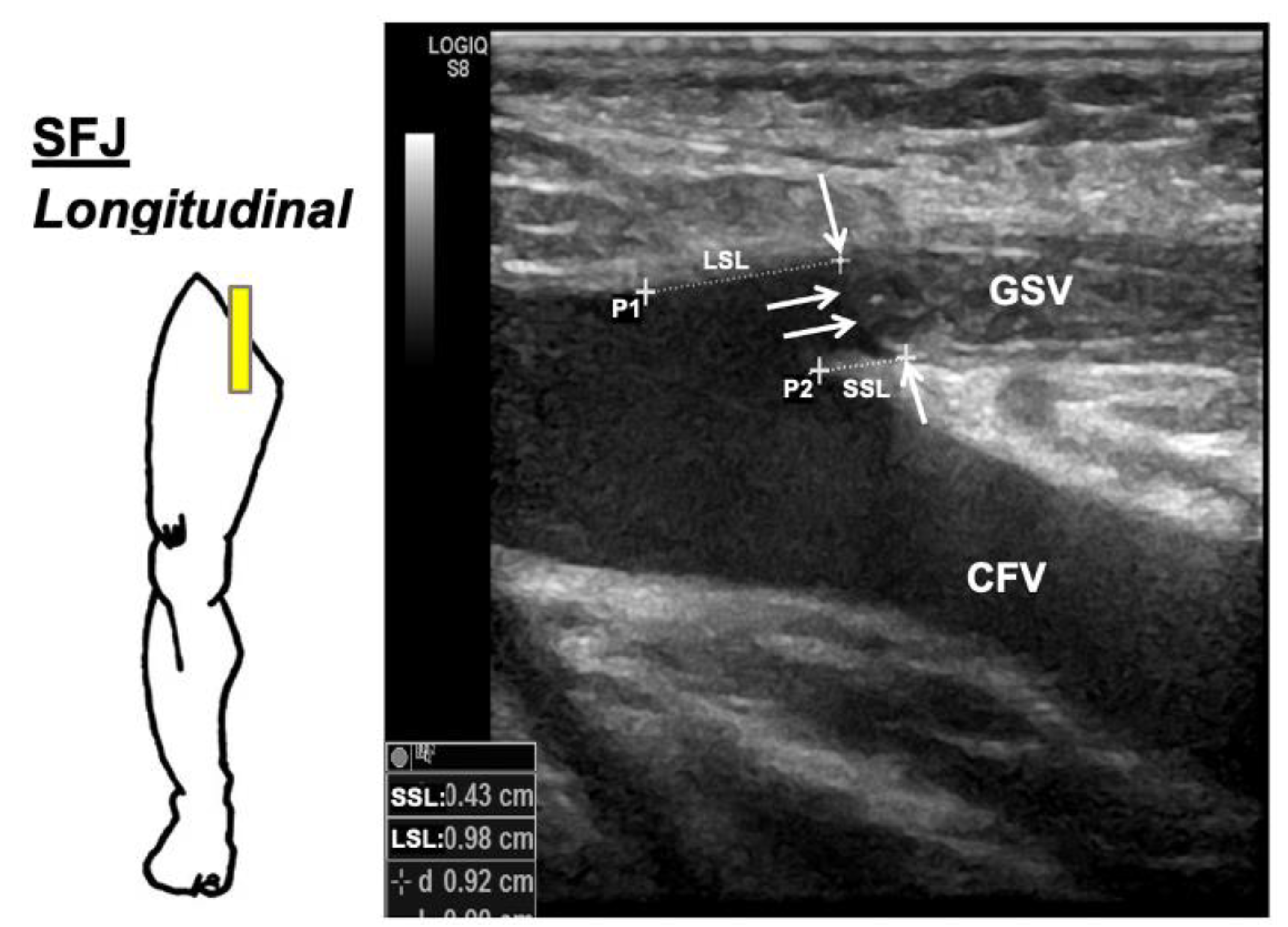 Jcm 12 04313 g004 Jcm 12 04313 g004
