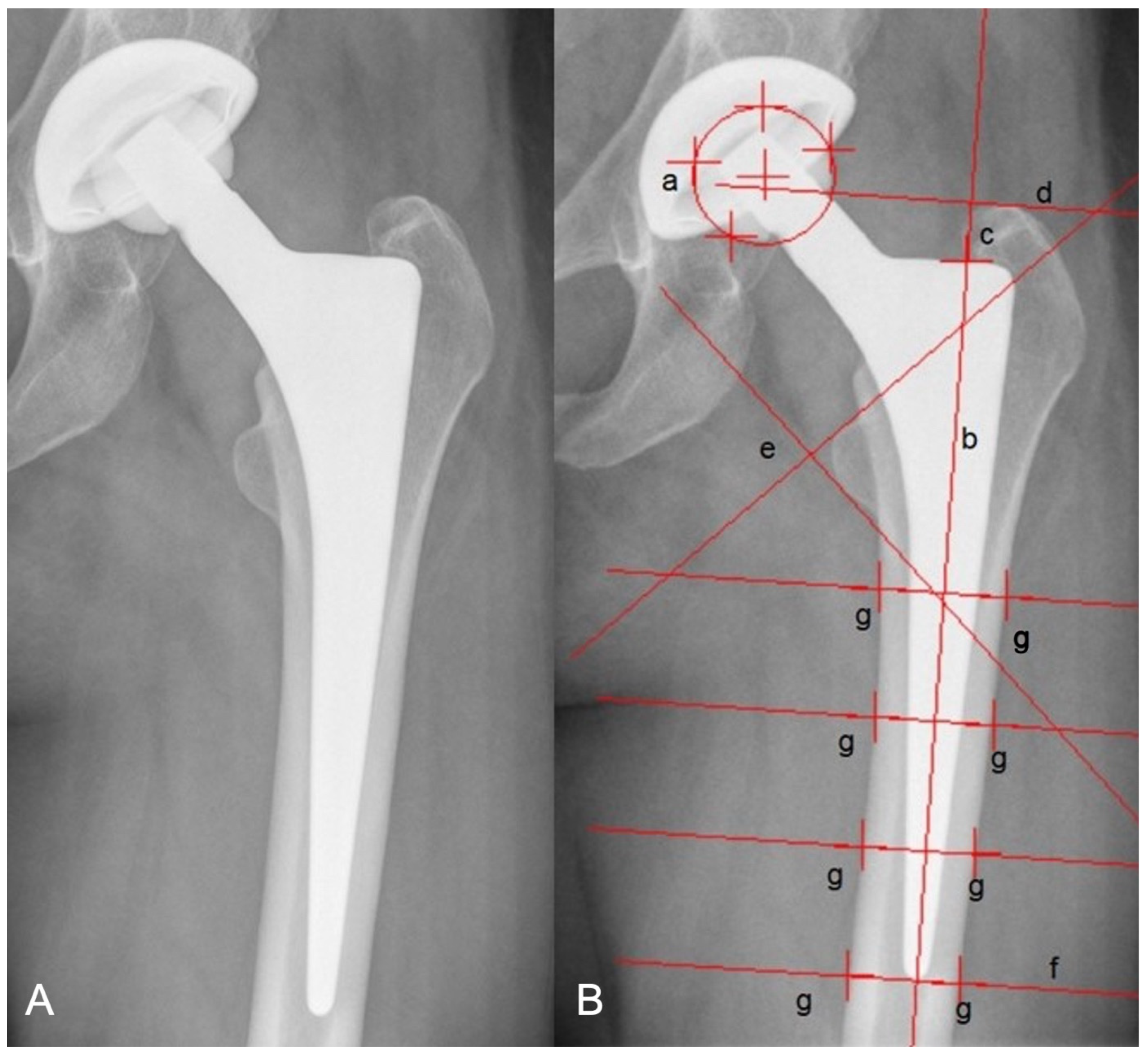 Jcm 12 04335 g001 Jcm 12 04335 g001