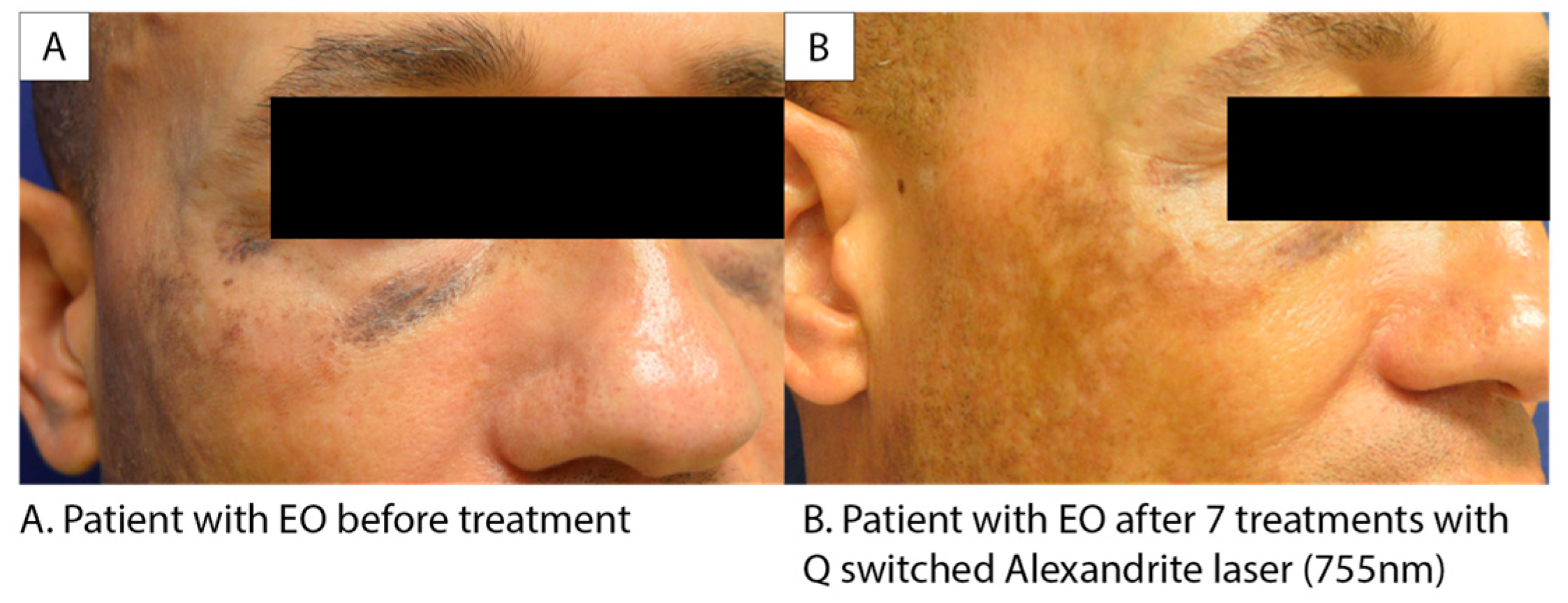 Jcm 12 04341 g001 550