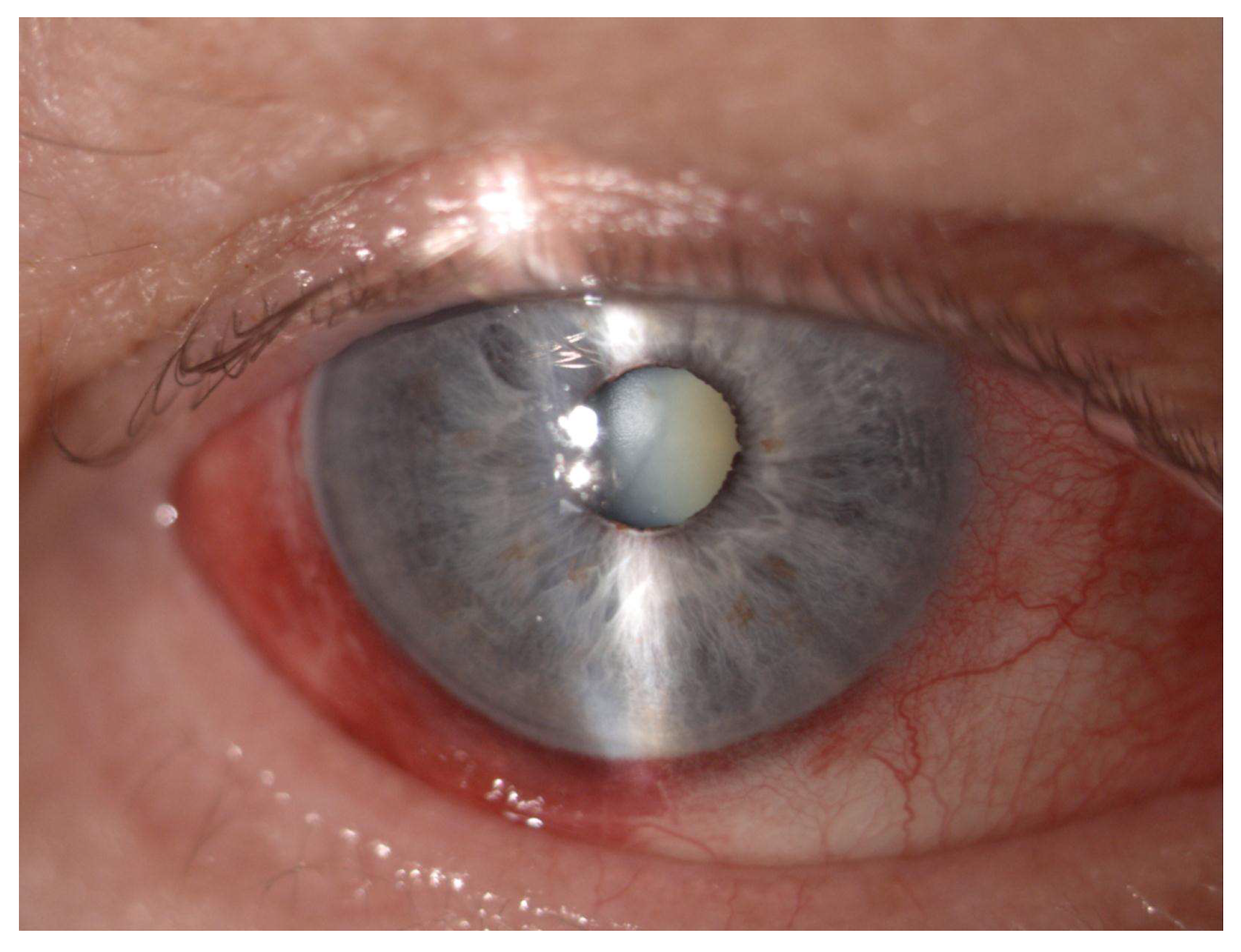 Jcm 12 04342 g004 Jcm 12 04342 g004