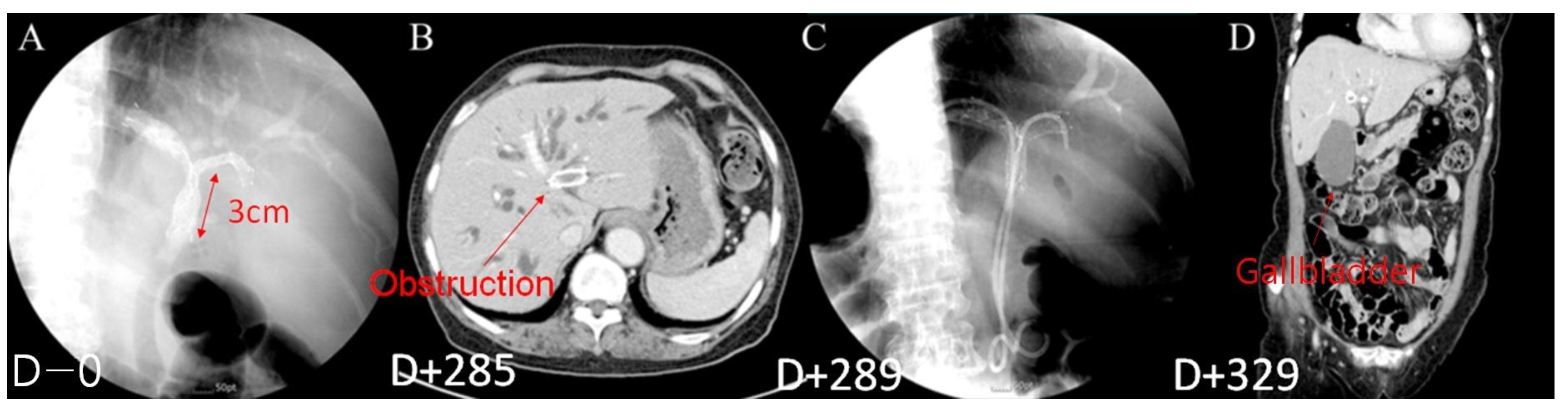 Jcm 12 04354 g005 Jcm 12 04354 g005