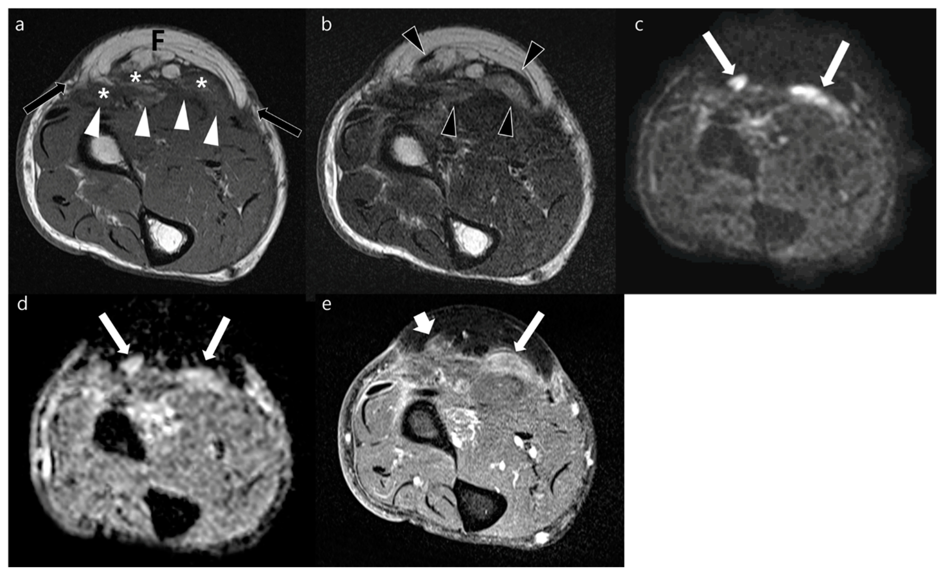 Jcm 12 04369 g004 Jcm 12 04369 g004