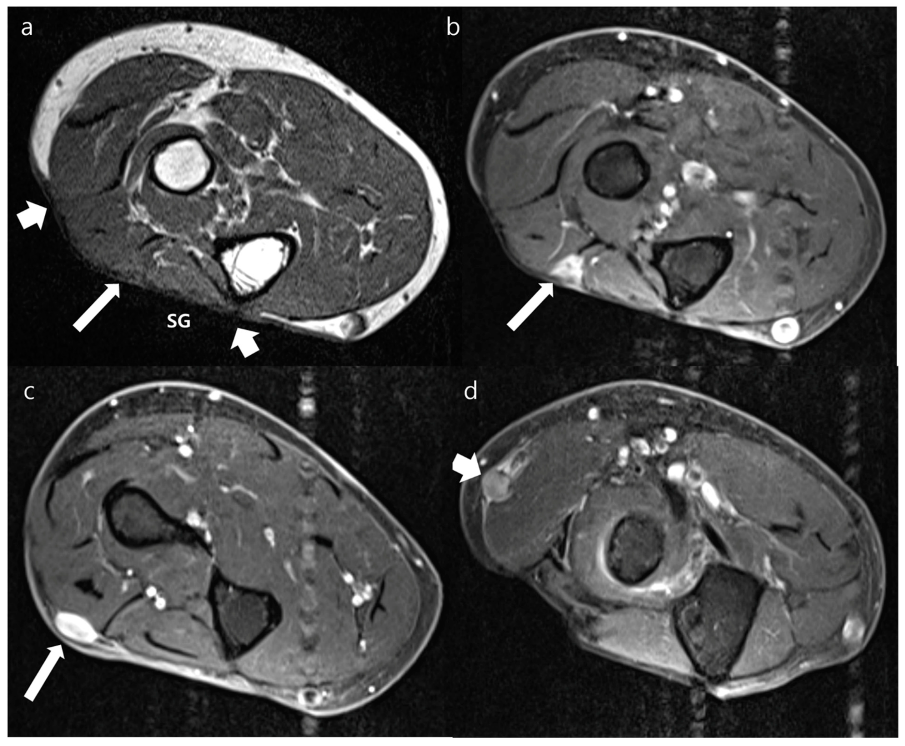 Jcm 12 04369 g006 Jcm 12 04369 g006