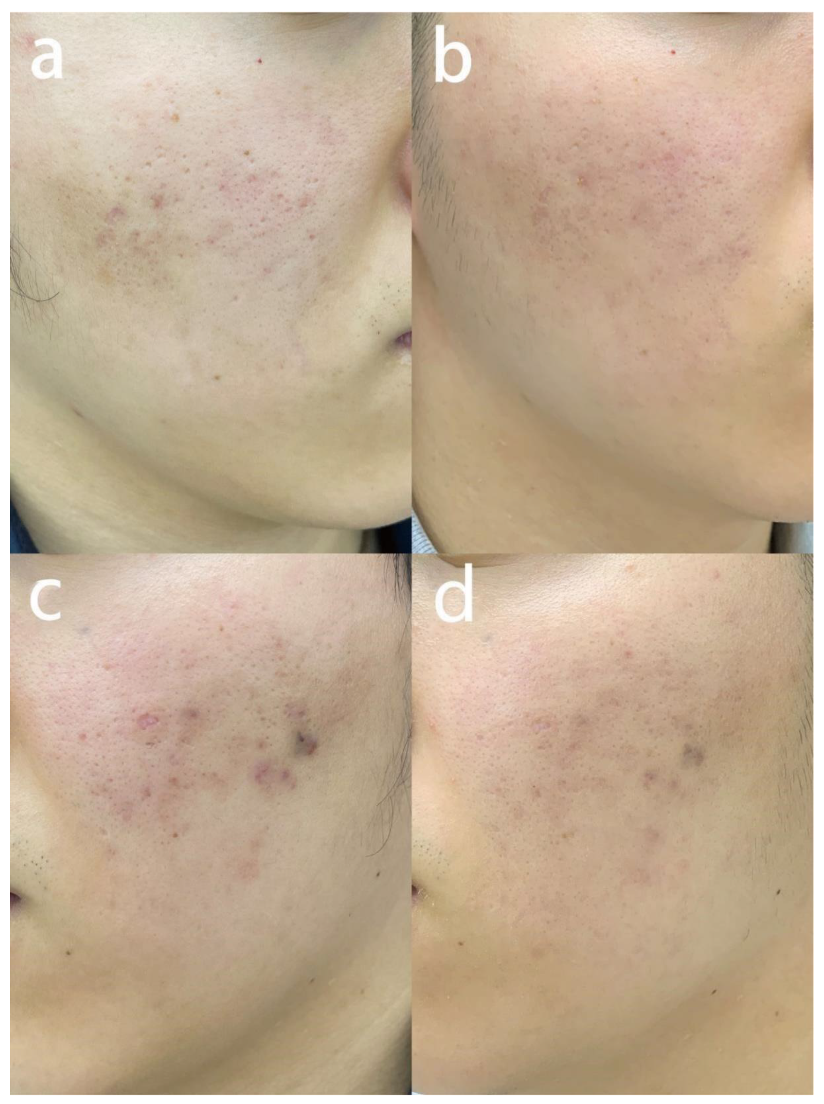 Jcm 12 04388 g004 Jcm 12 04388 g004