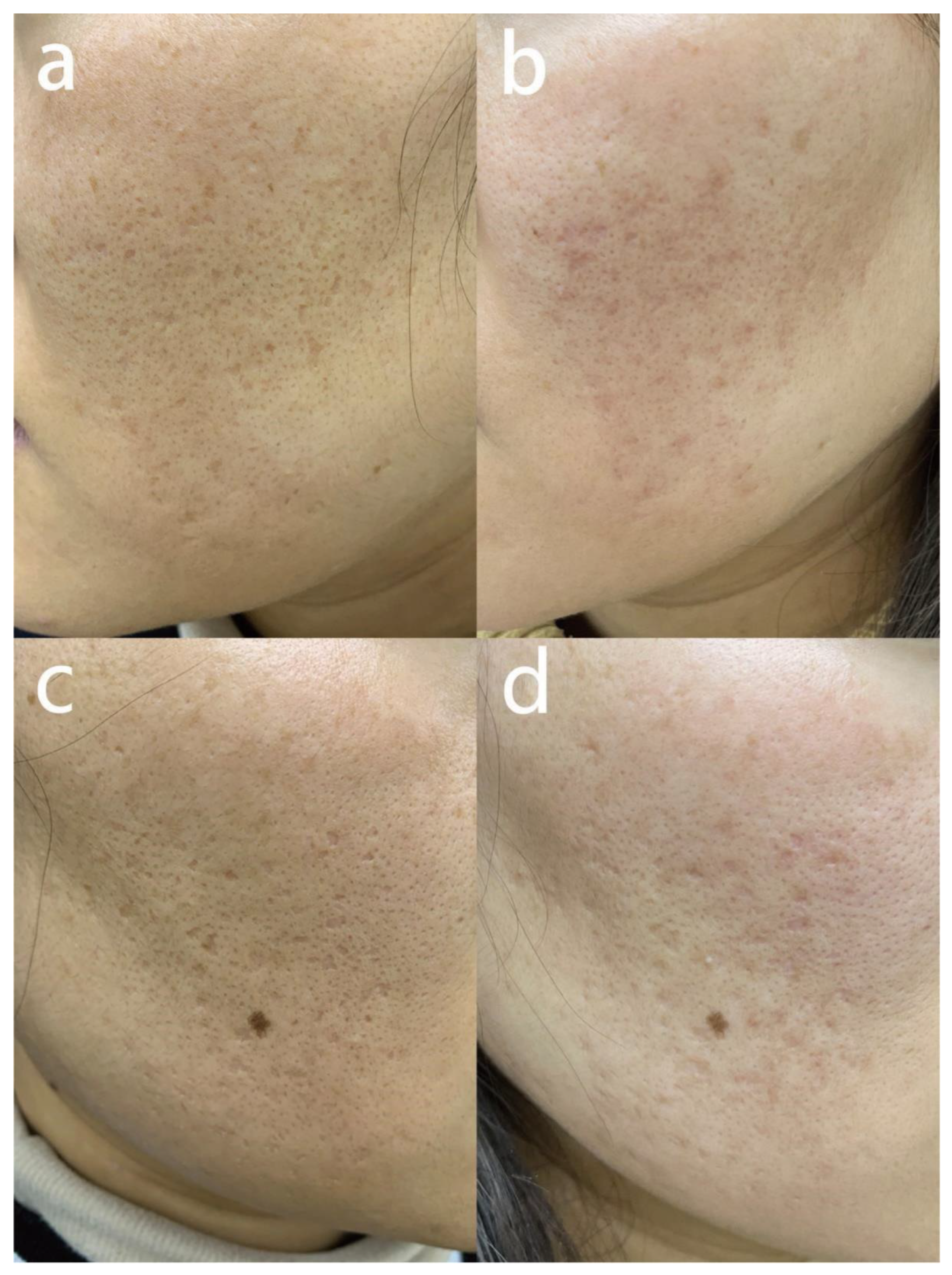 Jcm 12 04388 g005 Jcm 12 04388 g005