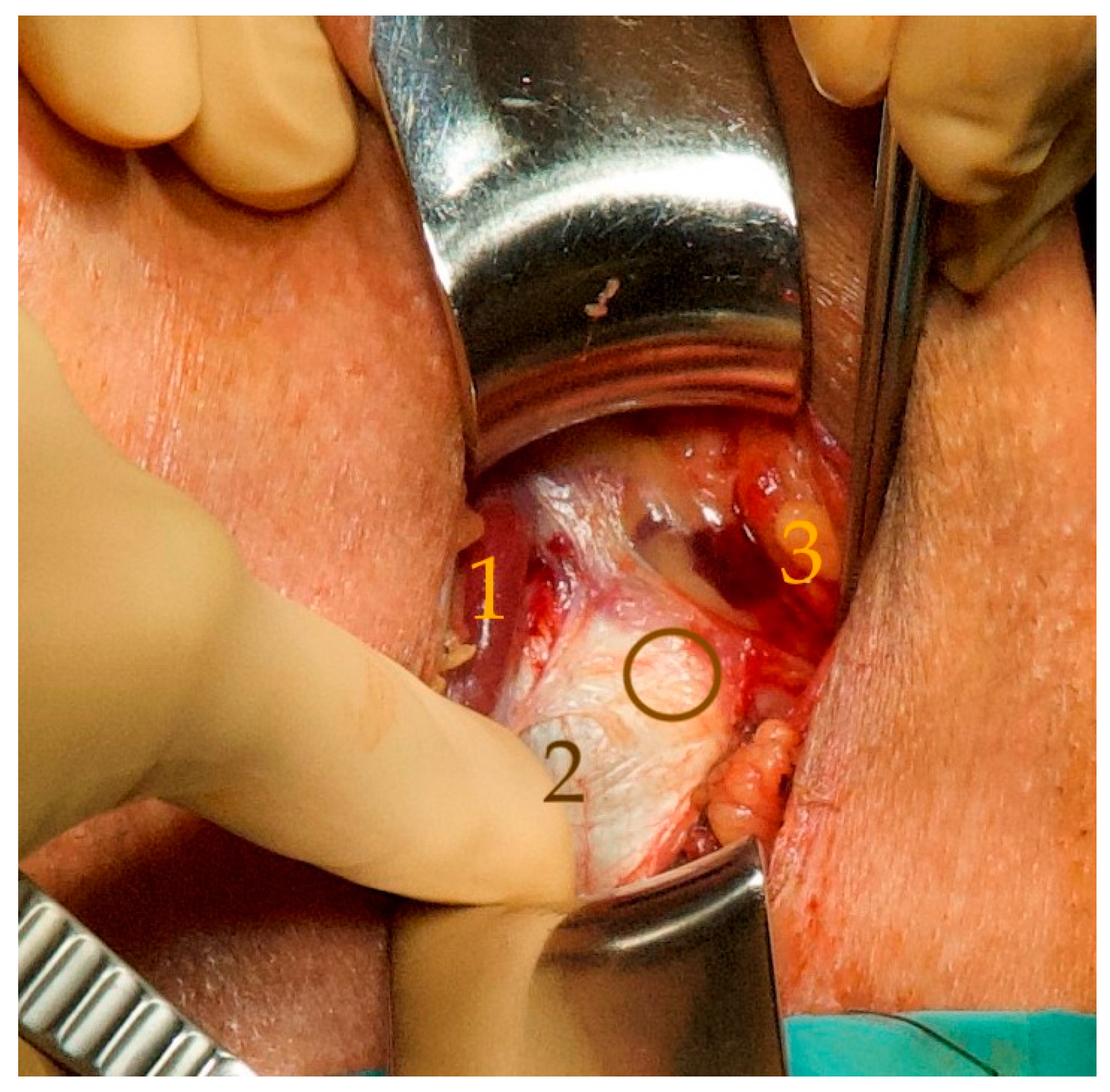 Jcm 12 04409 g003 Jcm 12 04409 g003