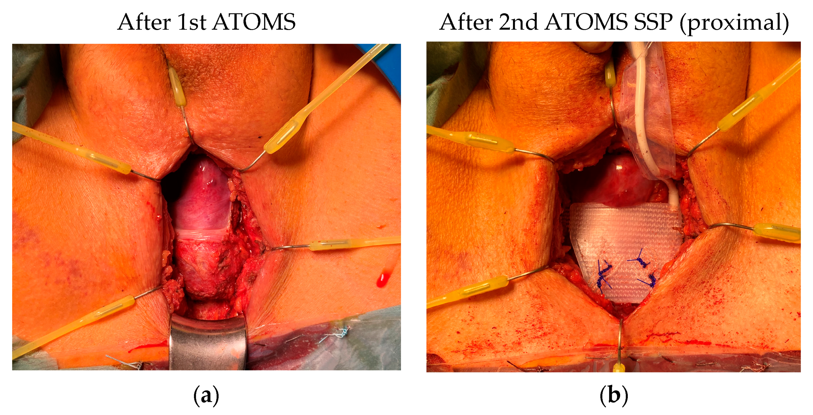 Jcm 12 04409 g008 Jcm 12 04409 g008