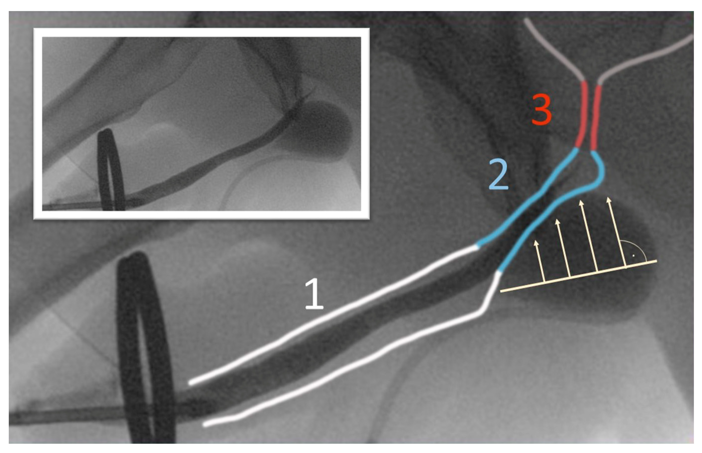 Jcm 12 04409 g009 Jcm 12 04409 g009