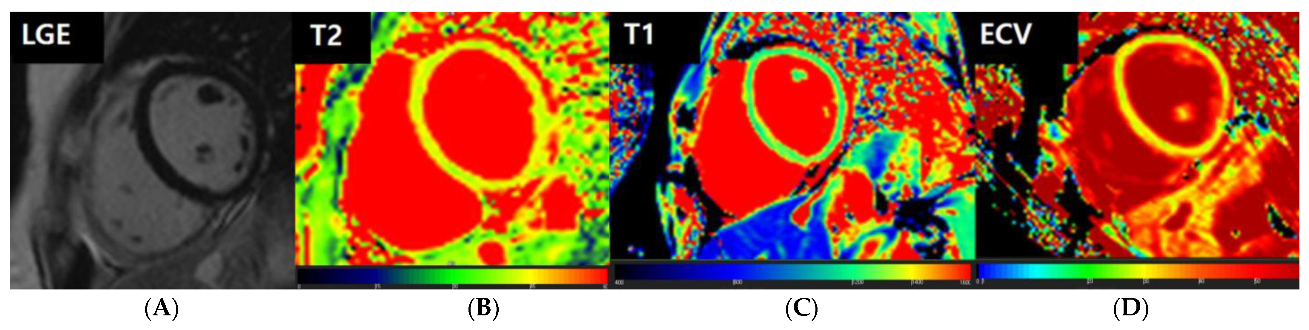 Jcm 12 04421 g005 Jcm 12 04421 g005