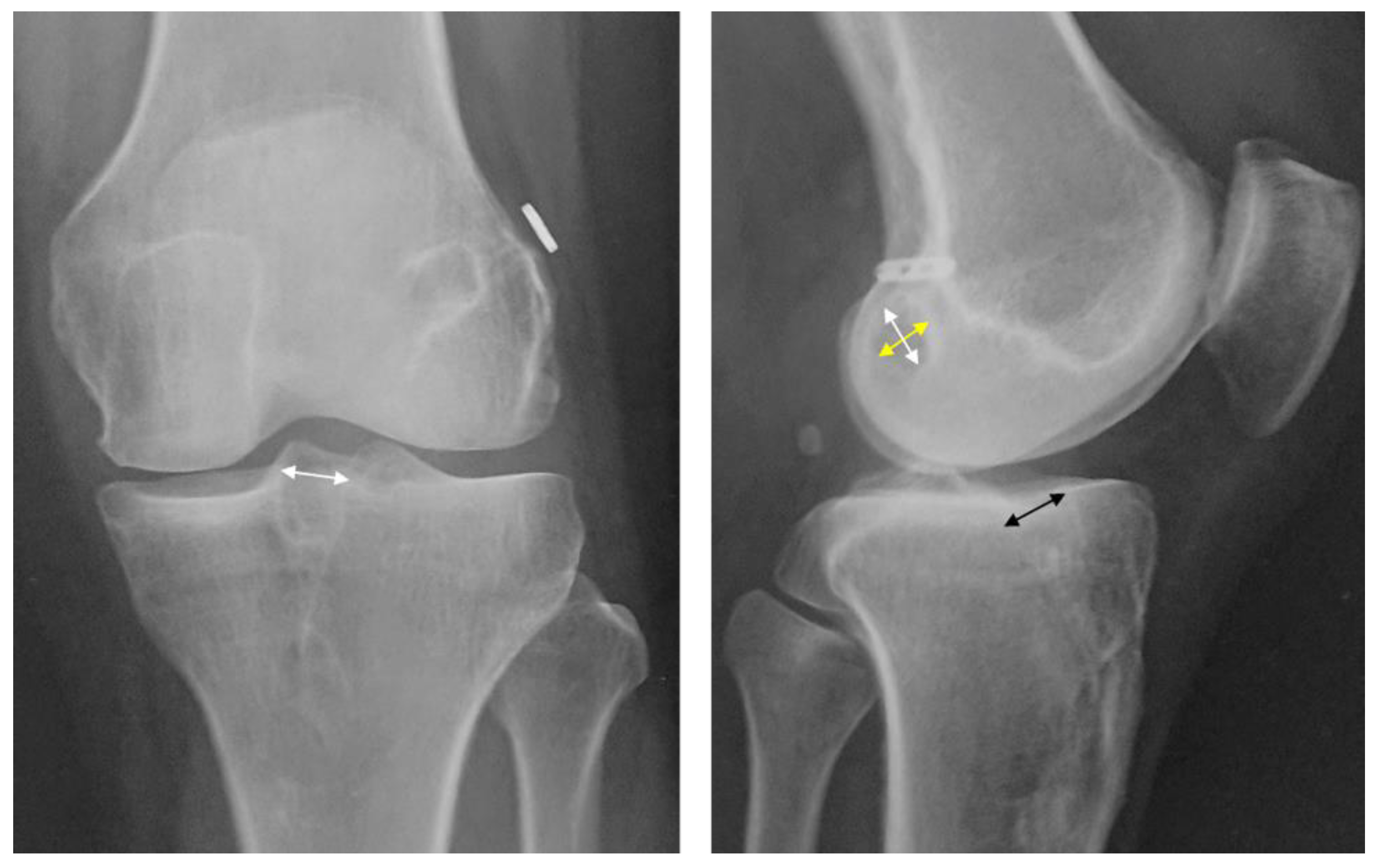 Jcm 12 04437 g001 Jcm 12 04437 g001