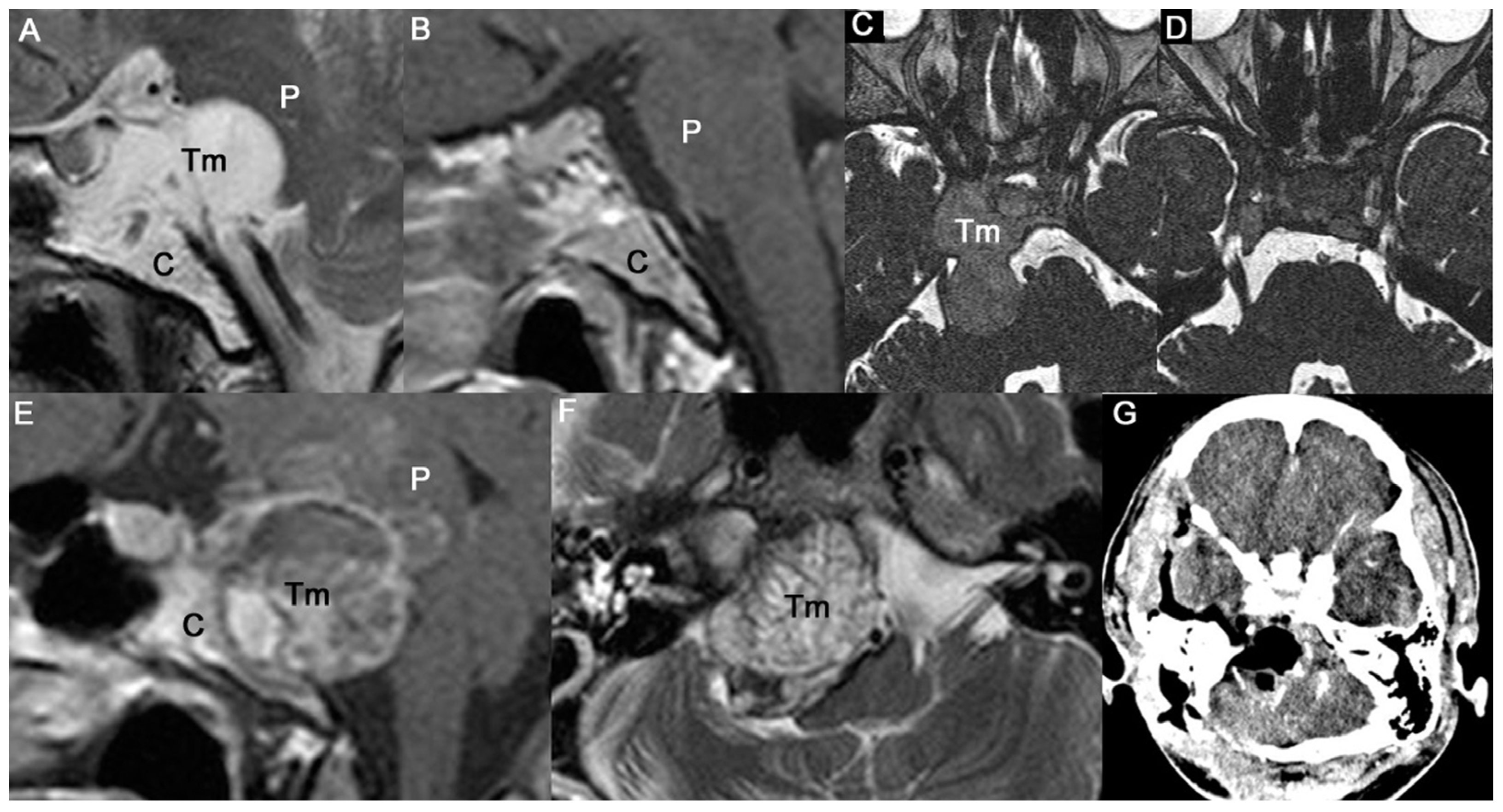 Jcm 12 04460 g004 Jcm 12 04460 g004