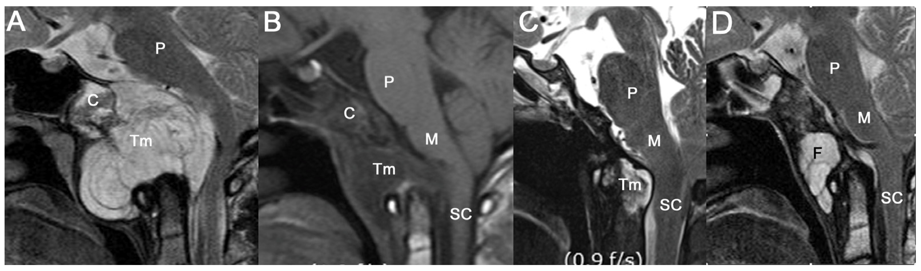 Jcm 12 04460 g005 Jcm 12 04460 g005
