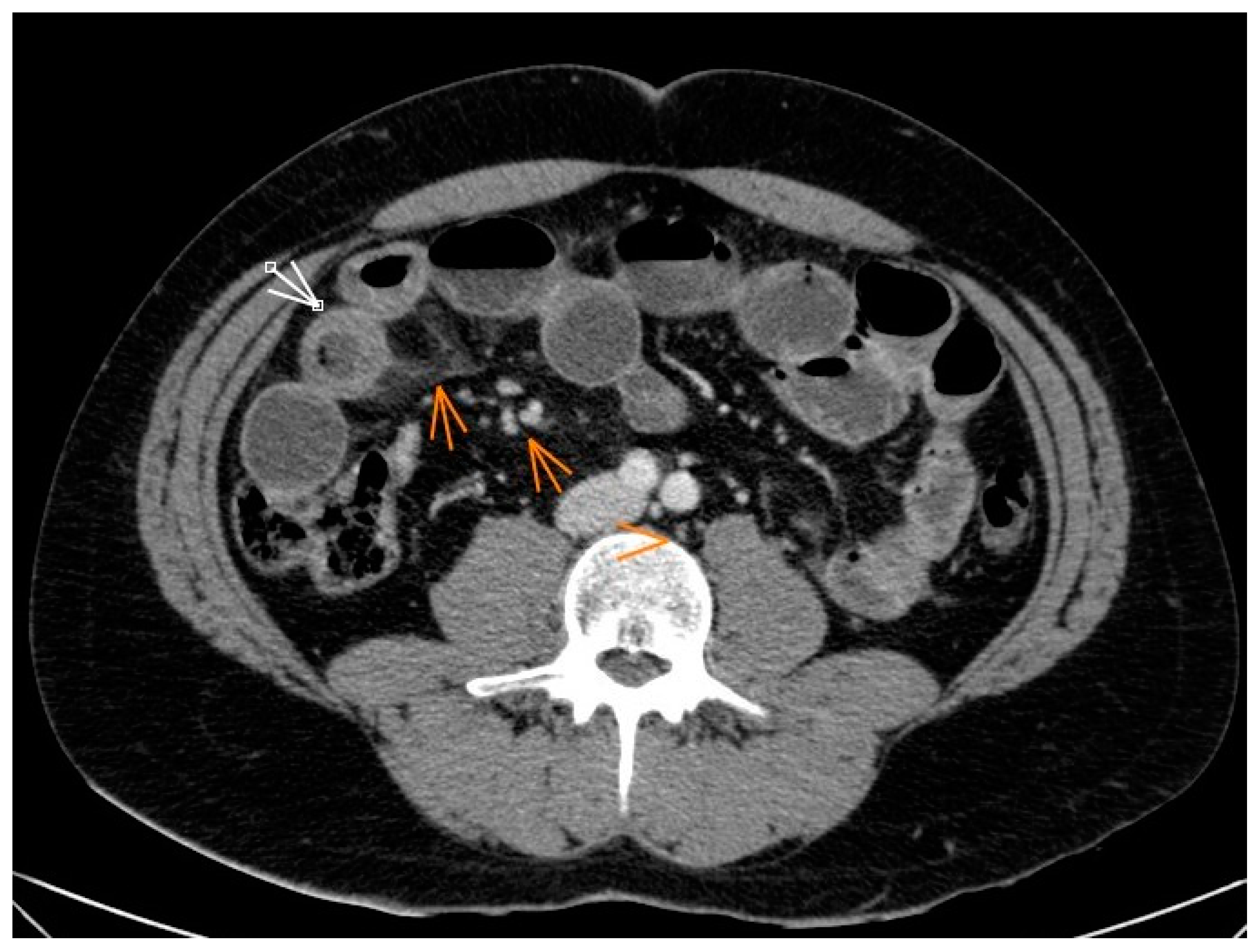 Jcm 12 04470 g001 Jcm 12 04470 g001