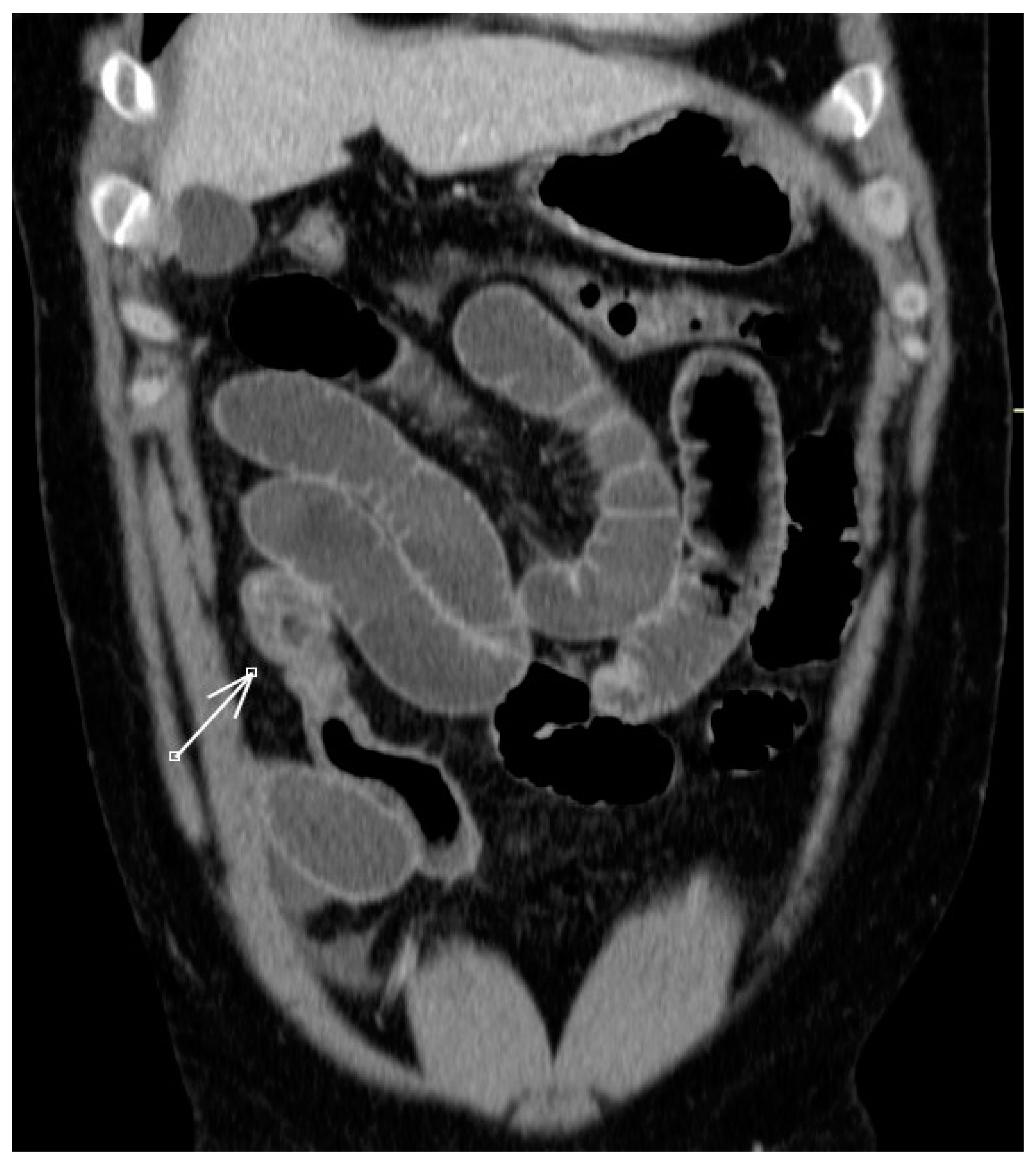 Jcm 12 04470 g002 Jcm 12 04470 g002