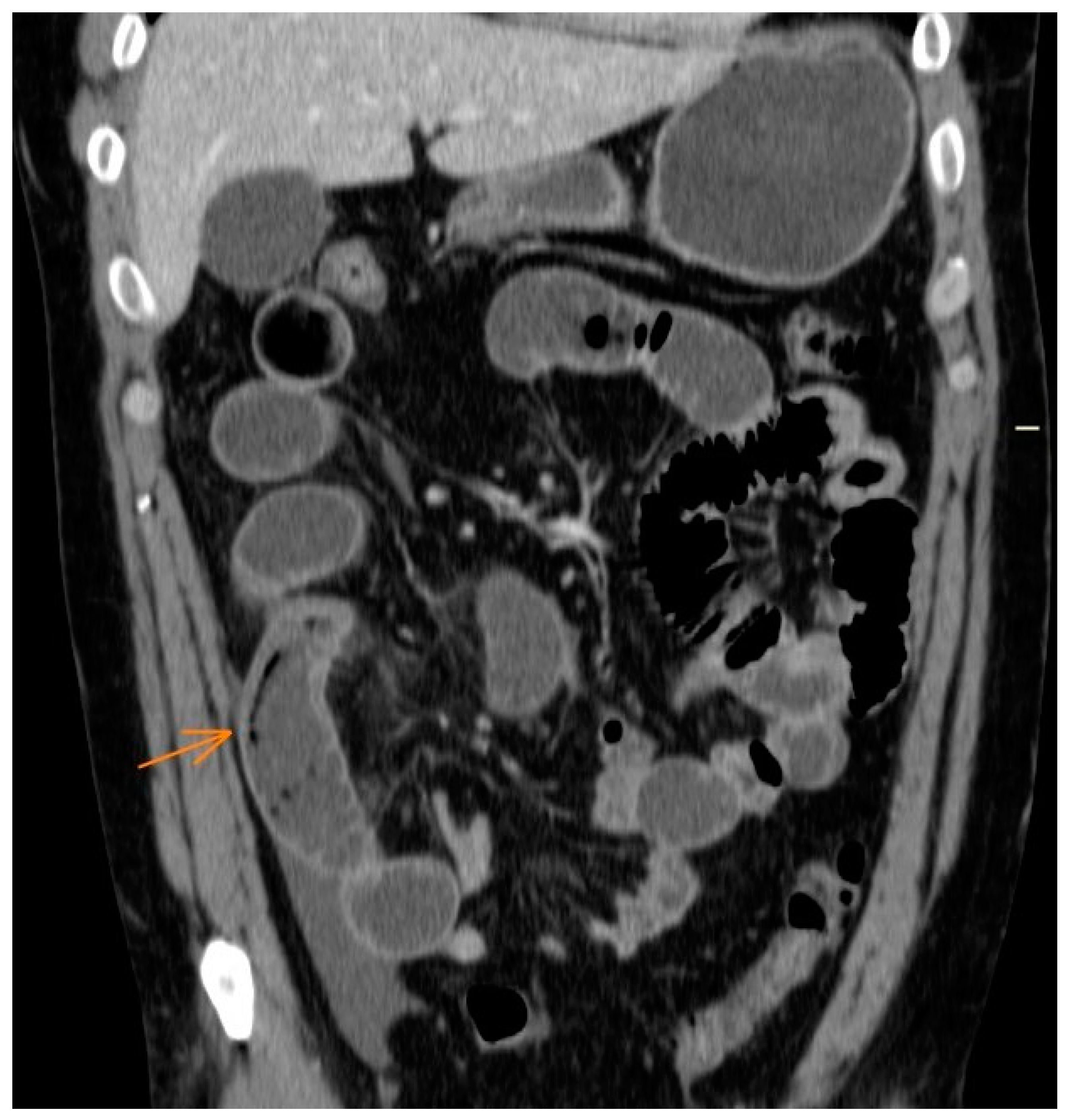 Jcm 12 04470 g003 Jcm 12 04470 g003