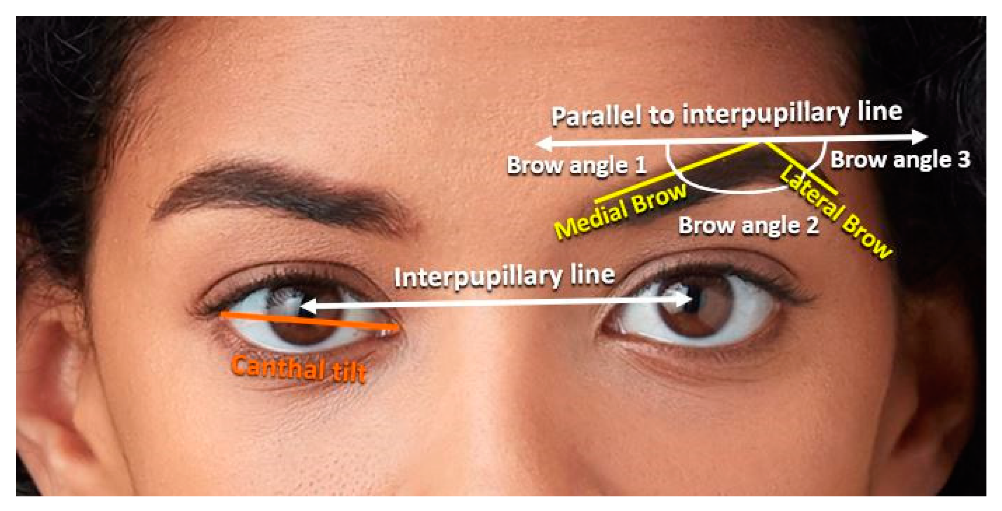 JCM | Free Full-Text | Facial Morphometrics in Black Celebrities: Contemporary Facial Analysis