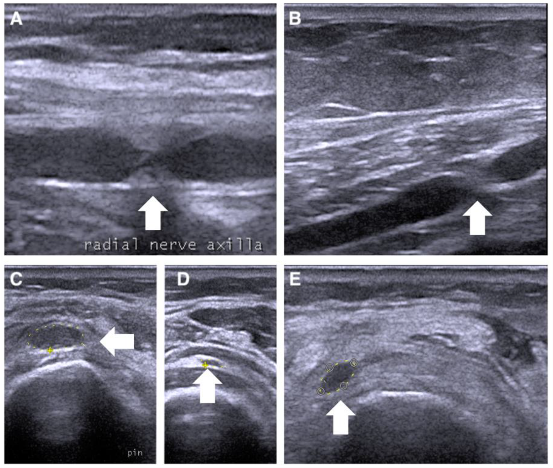 Jcm 12 04542 g003 Jcm 12 04542 g003