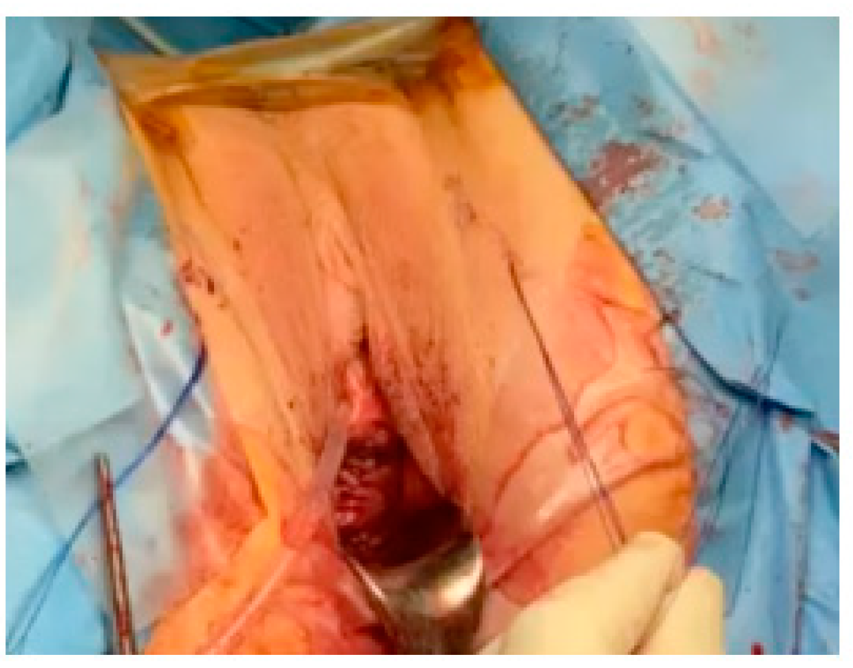 Jcm 12 04582 g003 Jcm 12 04582 g003