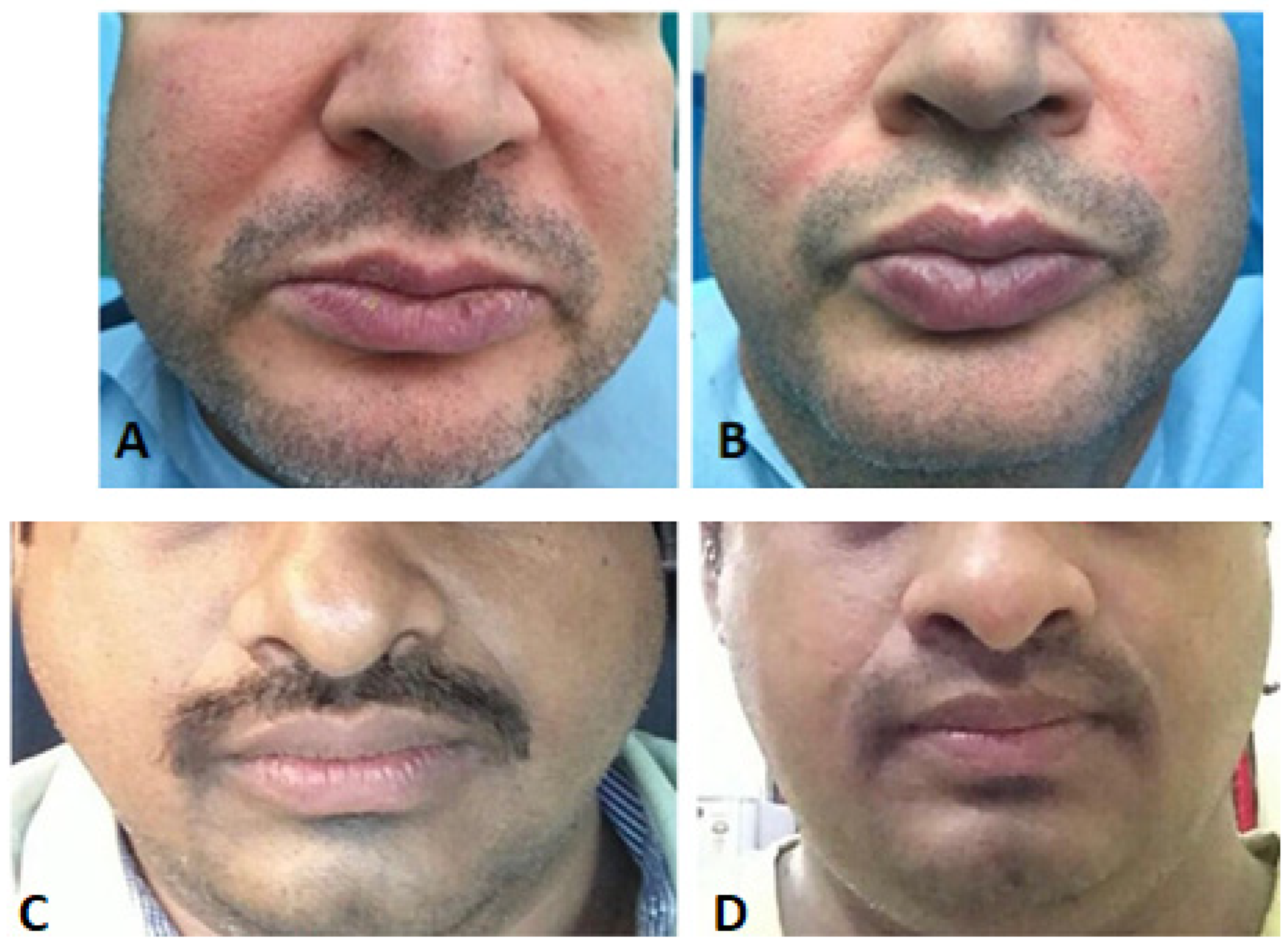 Jcm 12 04586 g003 Jcm 12 04586 g003