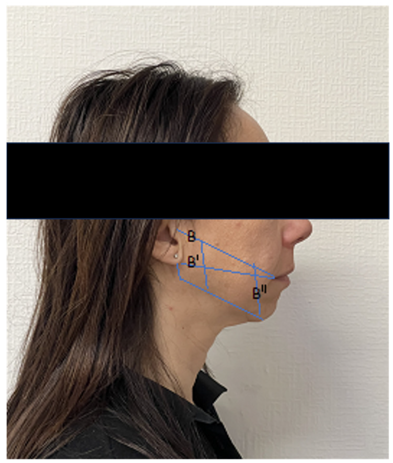 Jcm 12 04586 g004 Jcm 12 04586 g004