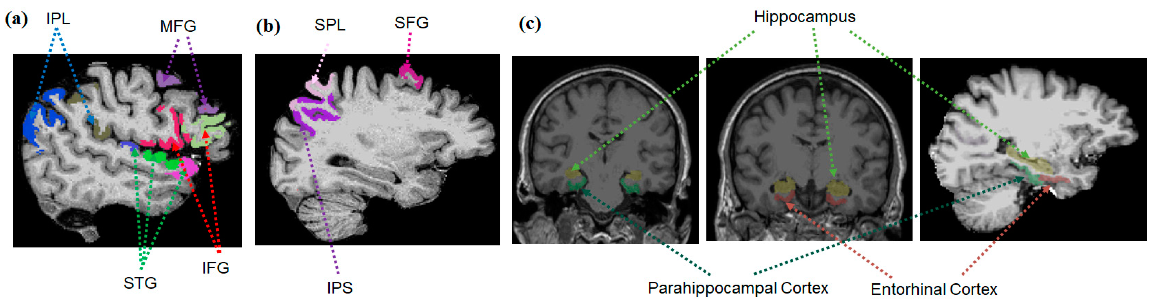 Jcm 12 04594 g003 Jcm 12 04594 g003