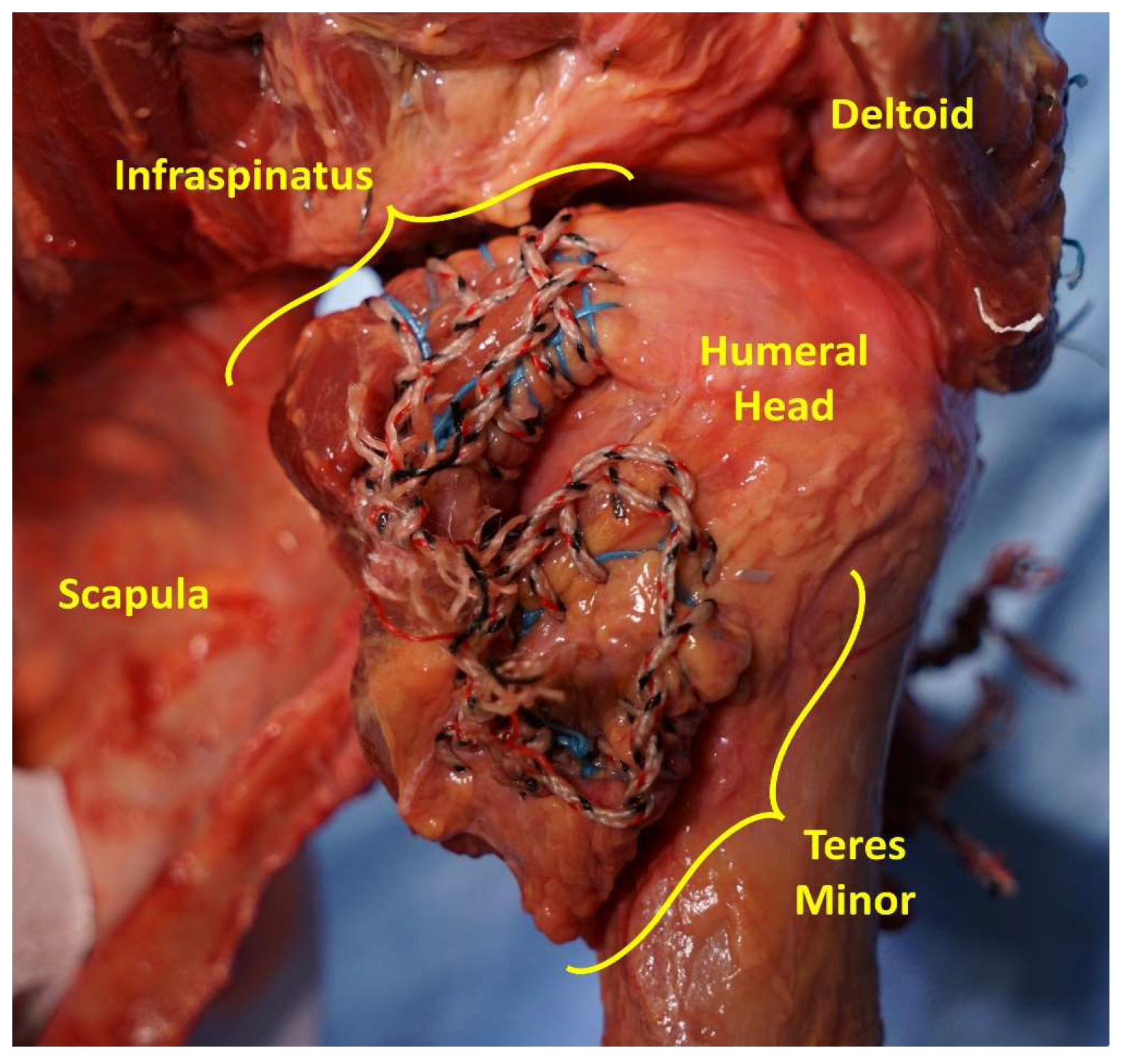 Jcm 12 04596 g002 Jcm 12 04596 g002