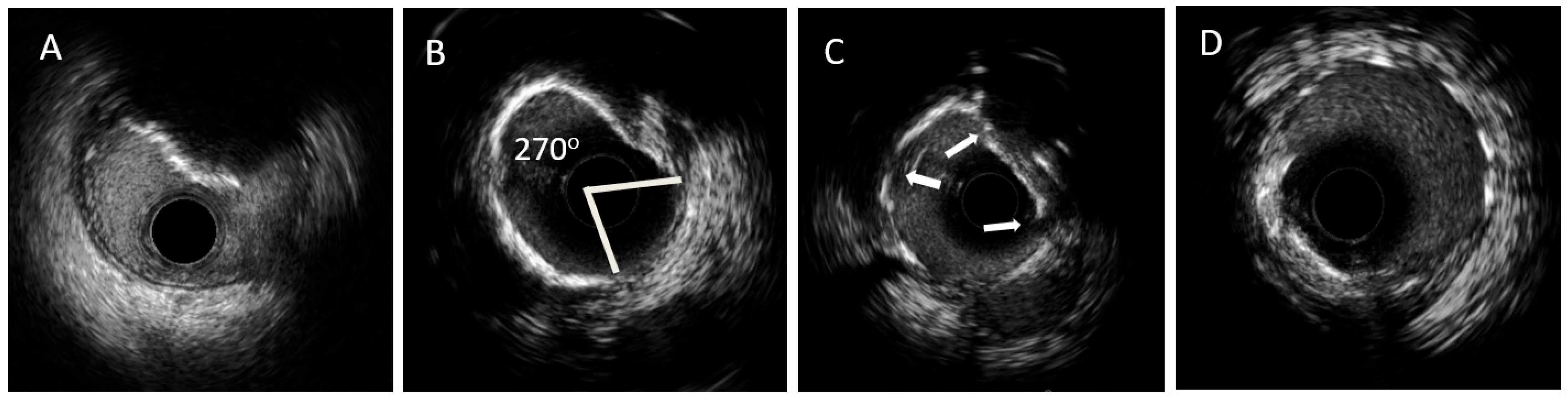 Jcm 12 04622 g001 Jcm 12 04622 g001