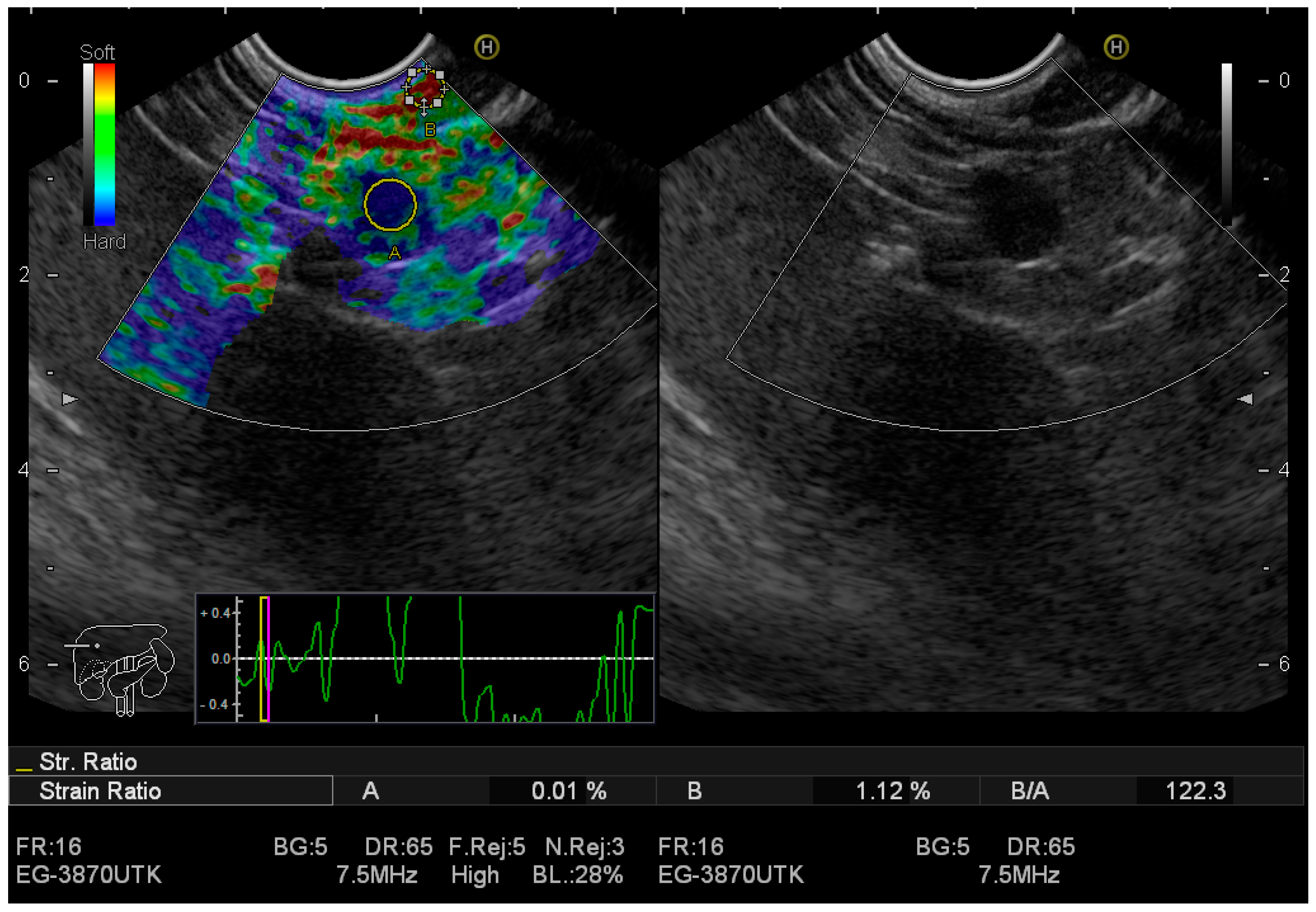 Jcm 12 04630 g002 Jcm 12 04630 g002