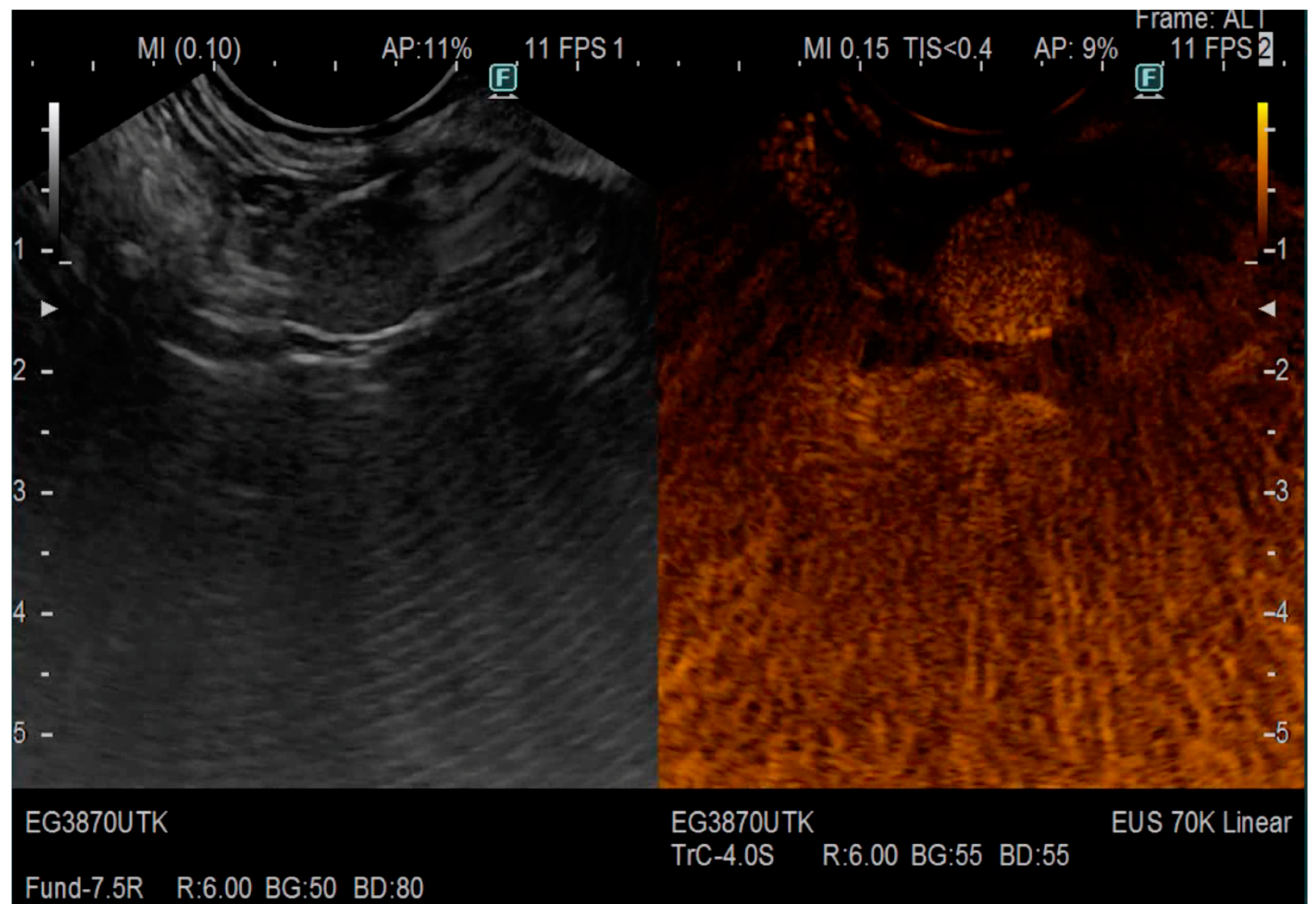 Jcm 12 04630 g003 Jcm 12 04630 g003