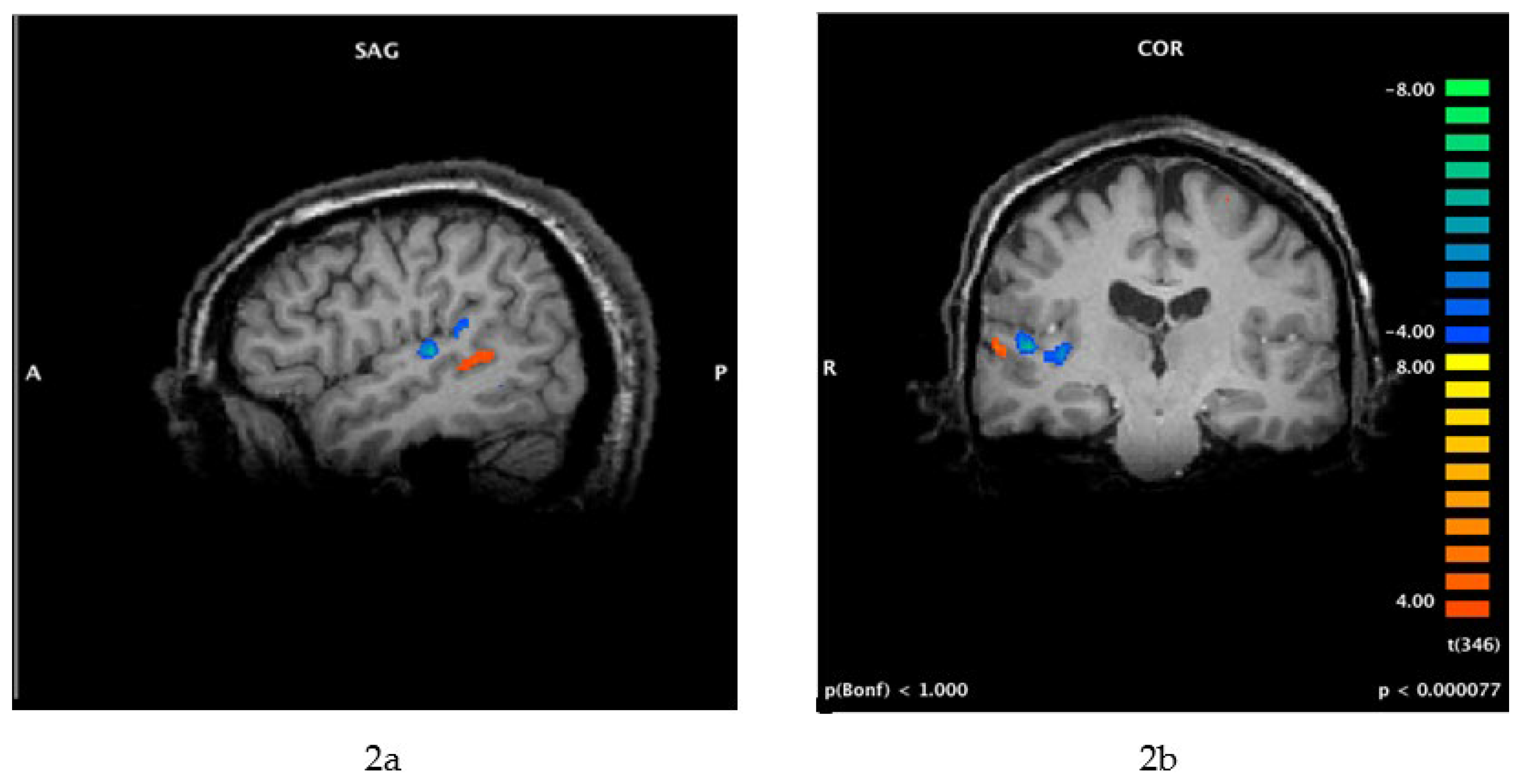 RightClick TMS for Opics