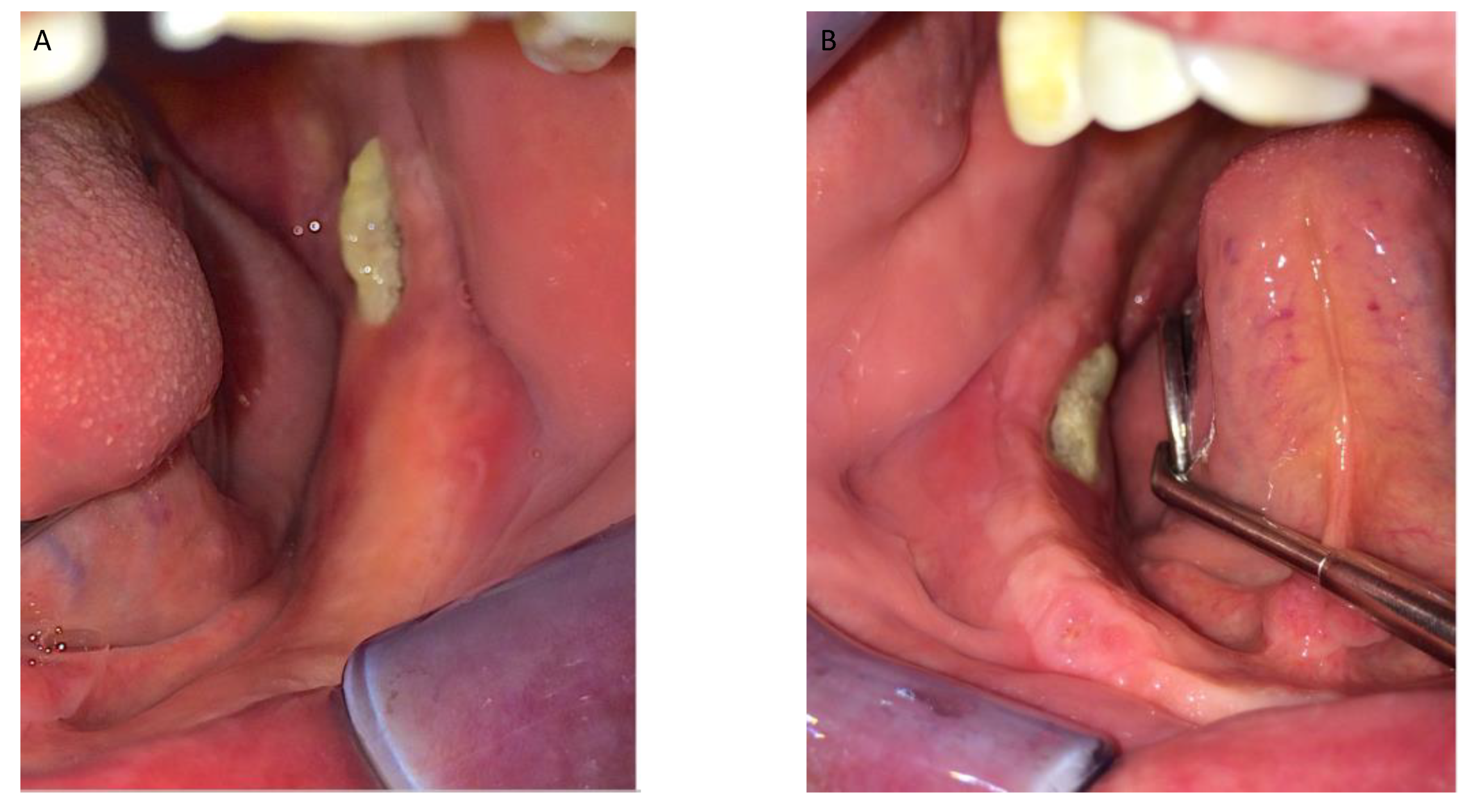 Jcm 12 04662 g001 Jcm 12 04662 g001