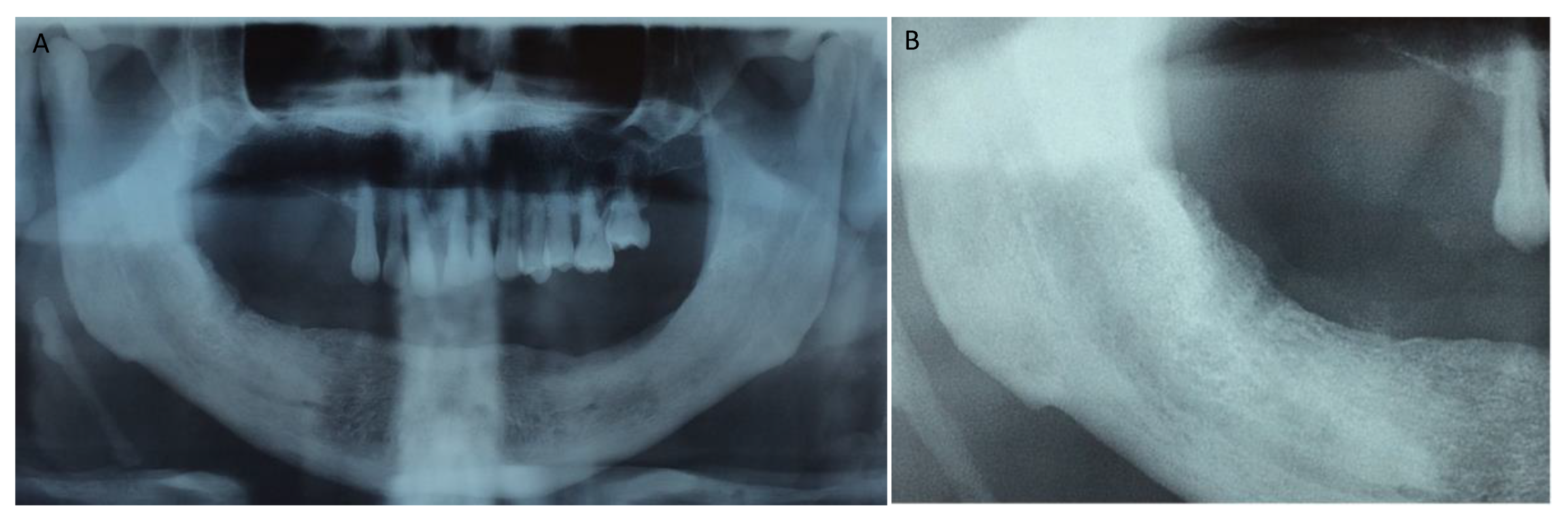 Jcm 12 04662 g002 Jcm 12 04662 g002