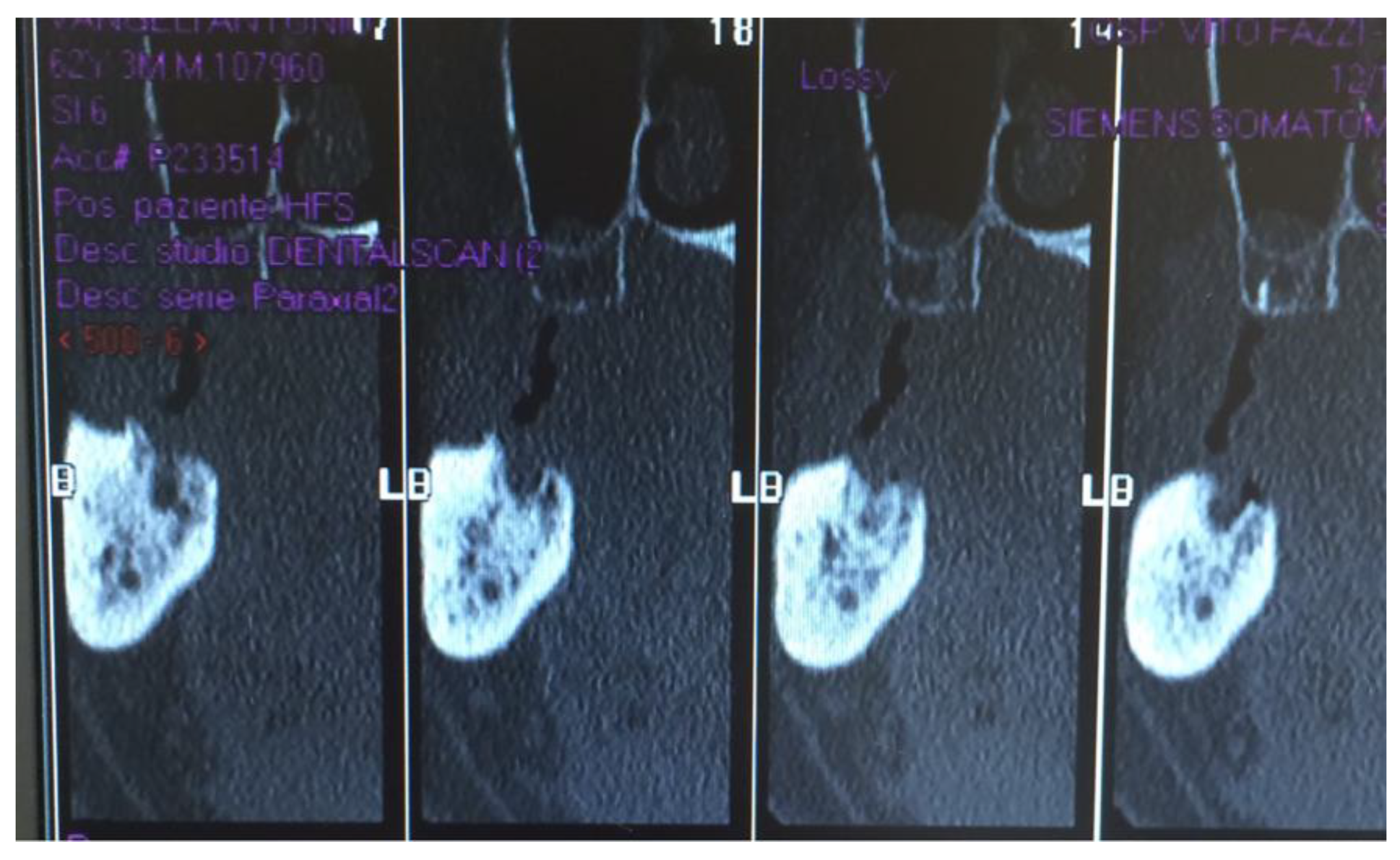 Jcm 12 04662 g003 Jcm 12 04662 g003