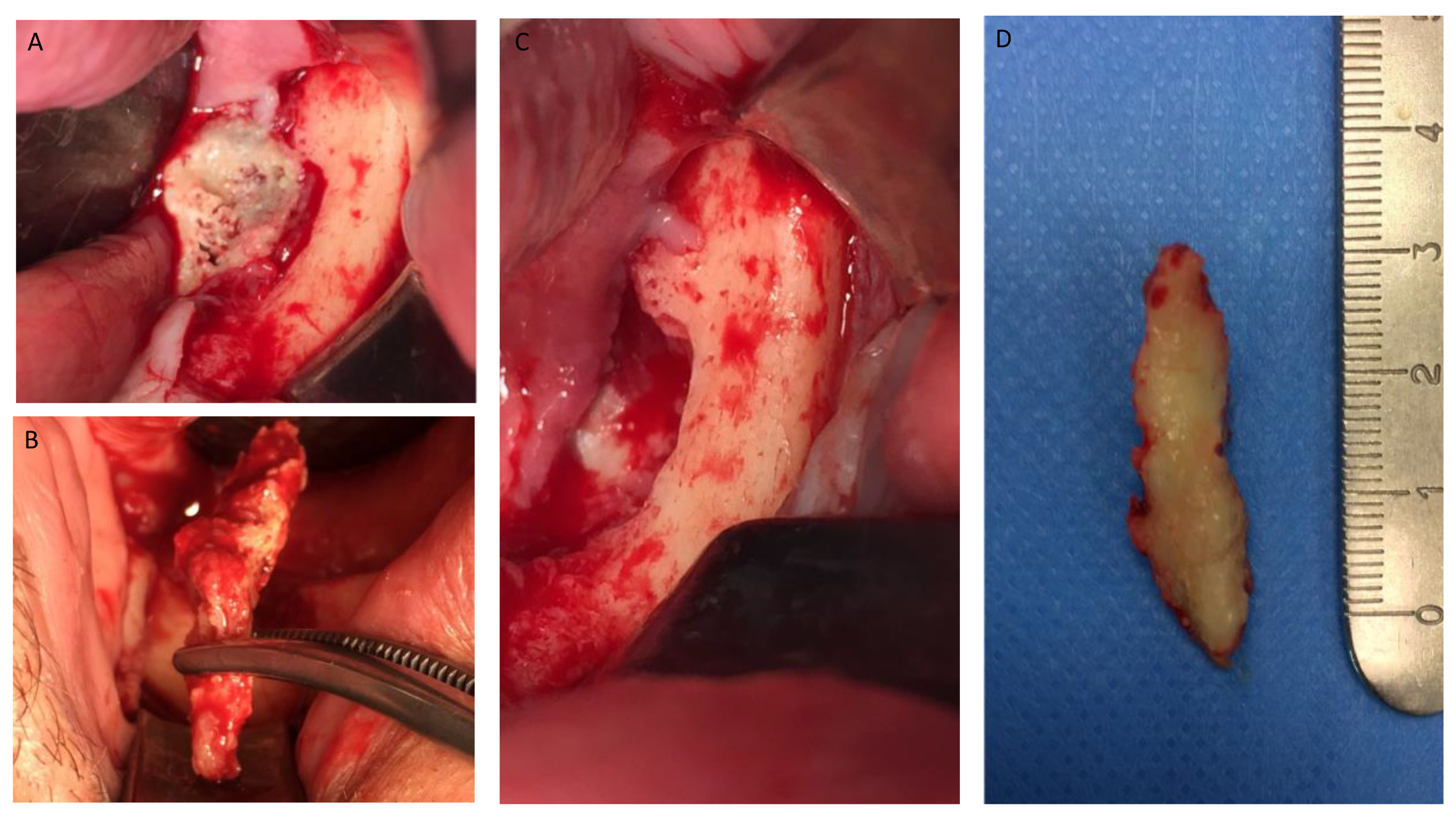 Jcm 12 04662 g005 Jcm 12 04662 g005