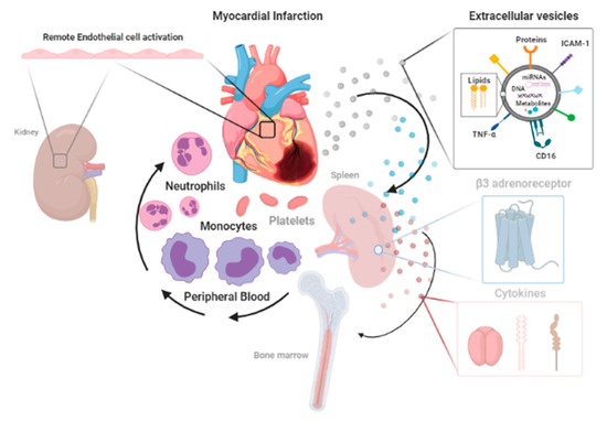 Prospects for Precision Medicine in Acute Myocardial Infarction ...