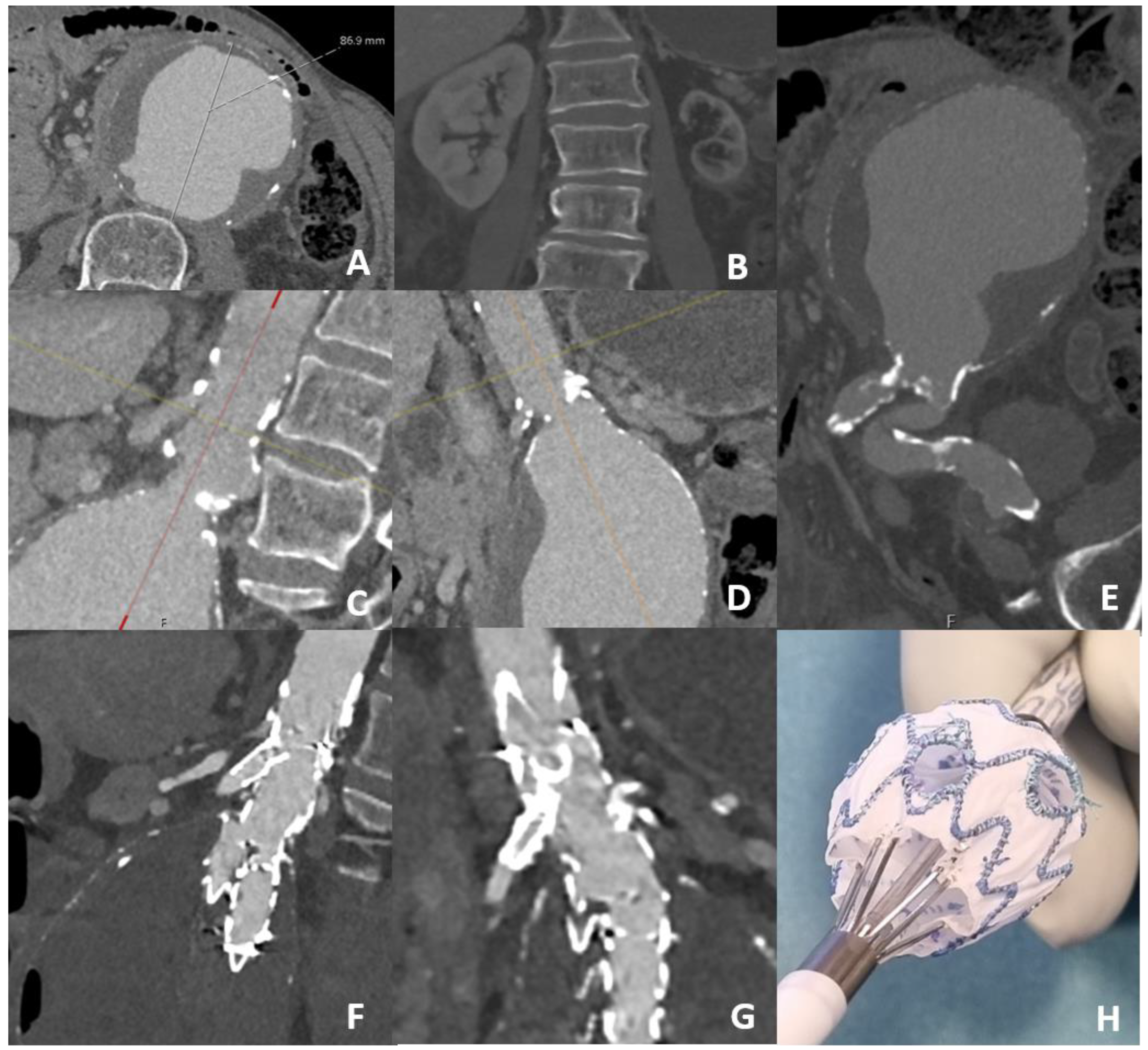 Jcm 12 04708 g001 Jcm 12 04708 g001