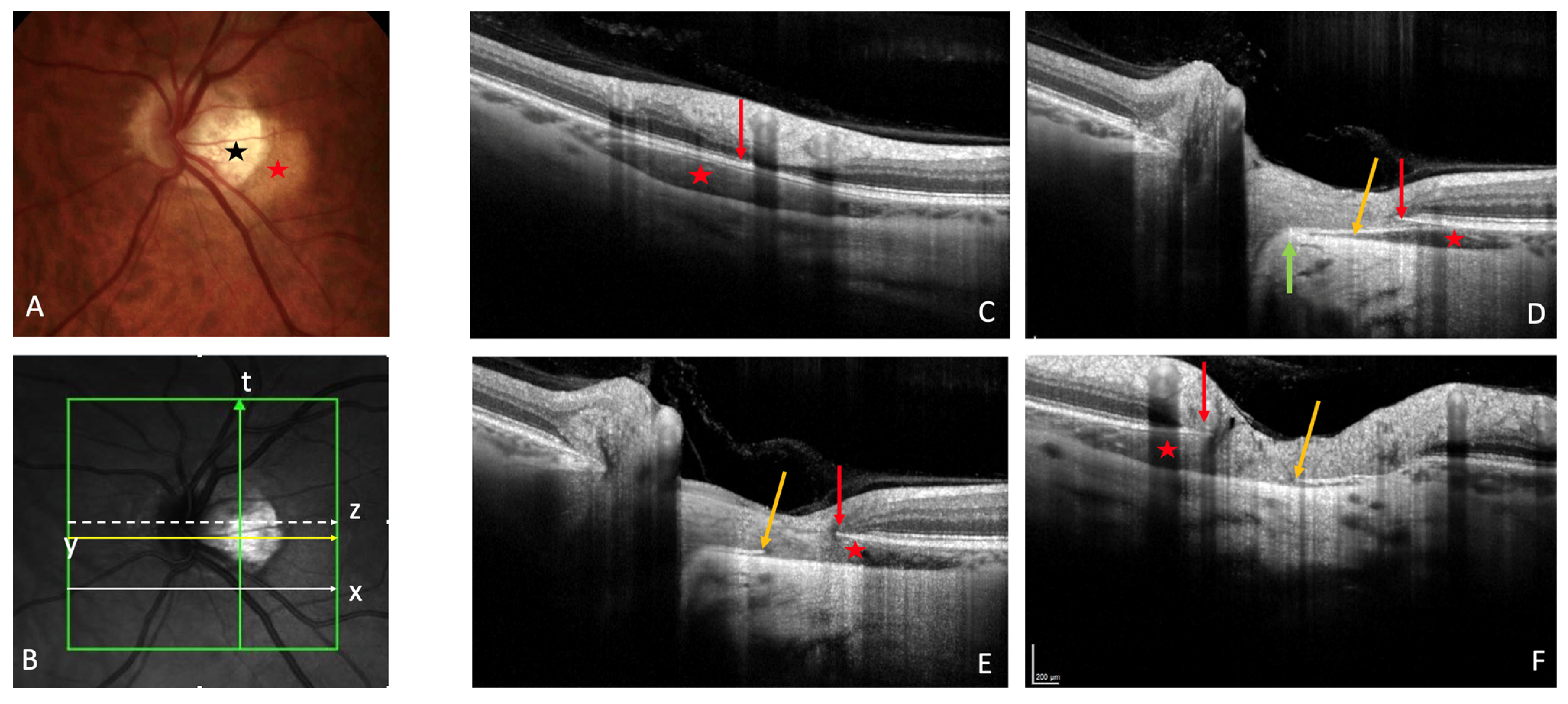 Jcm 12 04712 g001 Jcm 12 04712 g001