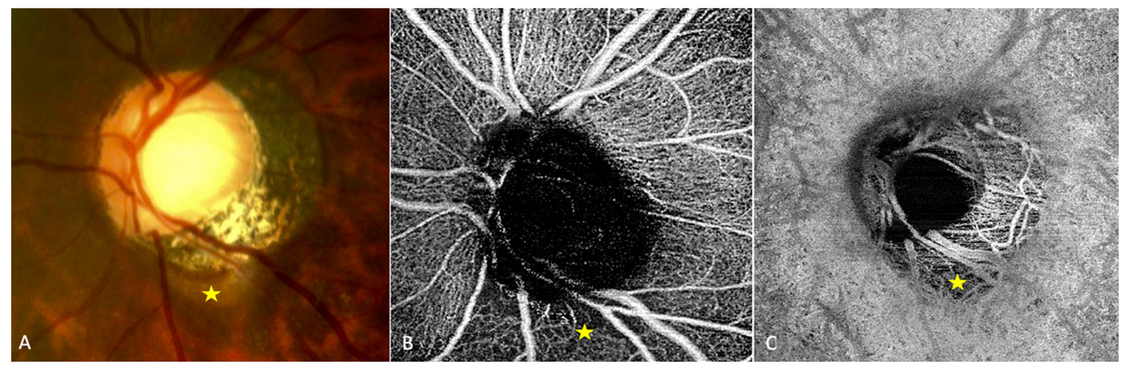 Jcm 12 04712 g002 Jcm 12 04712 g002