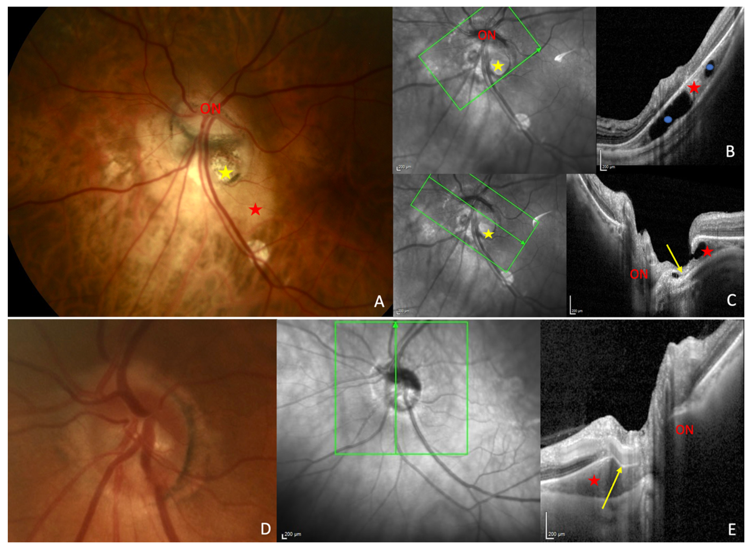 Jcm 12 04712 g004 Jcm 12 04712 g004