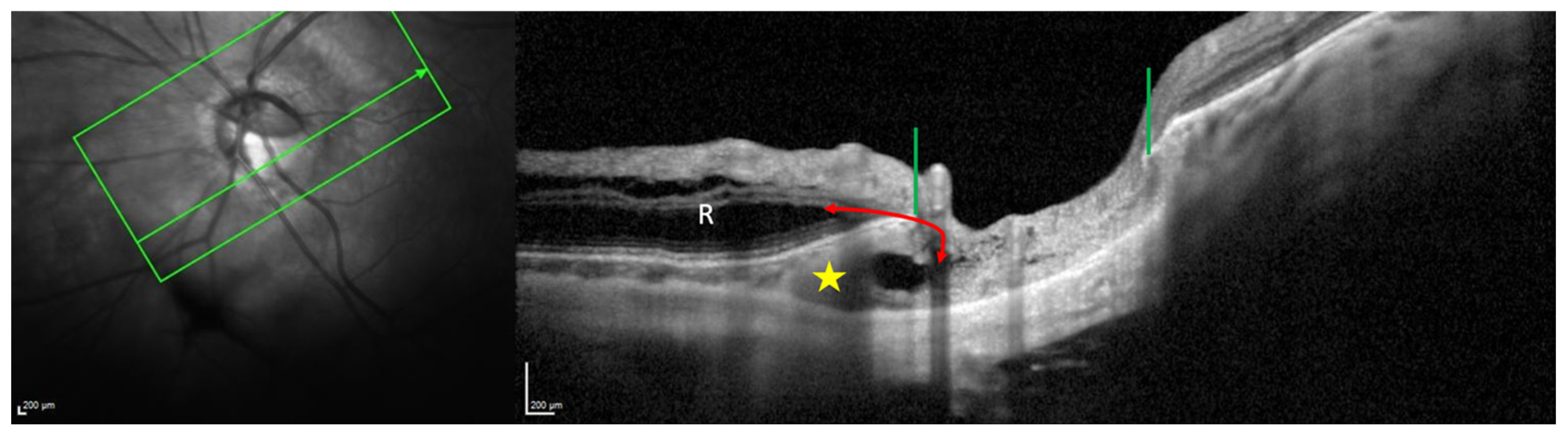 Jcm 12 04712 g006 Jcm 12 04712 g006