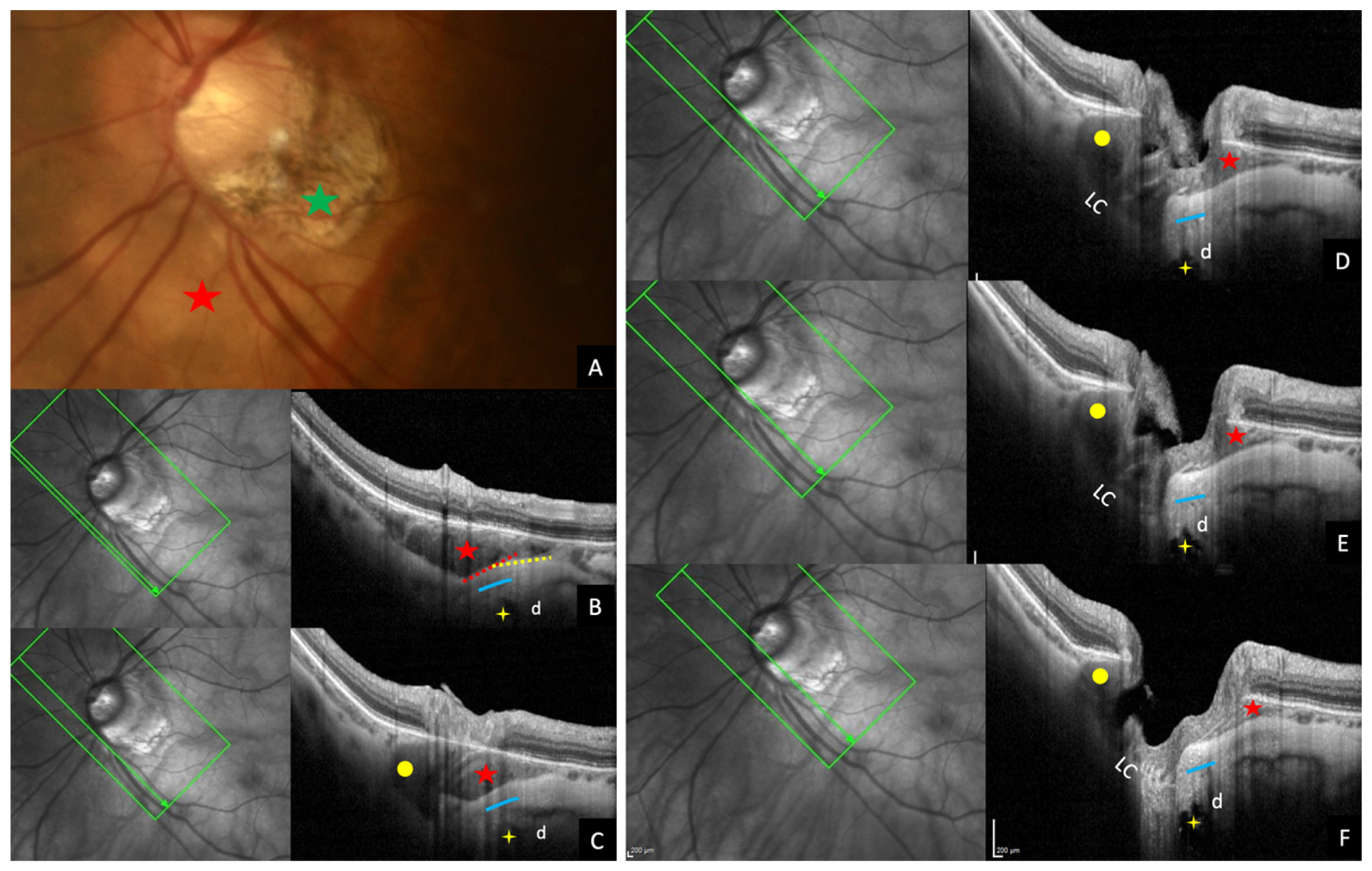 Jcm 12 04712 g007 Jcm 12 04712 g007